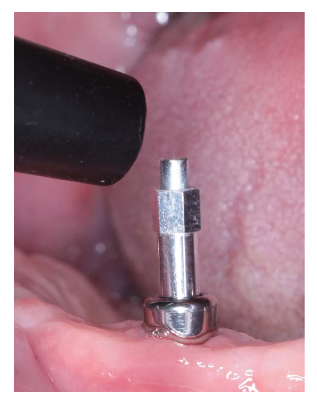 Ijerph 17 06733 g002 Ijerph 17 06733 g002