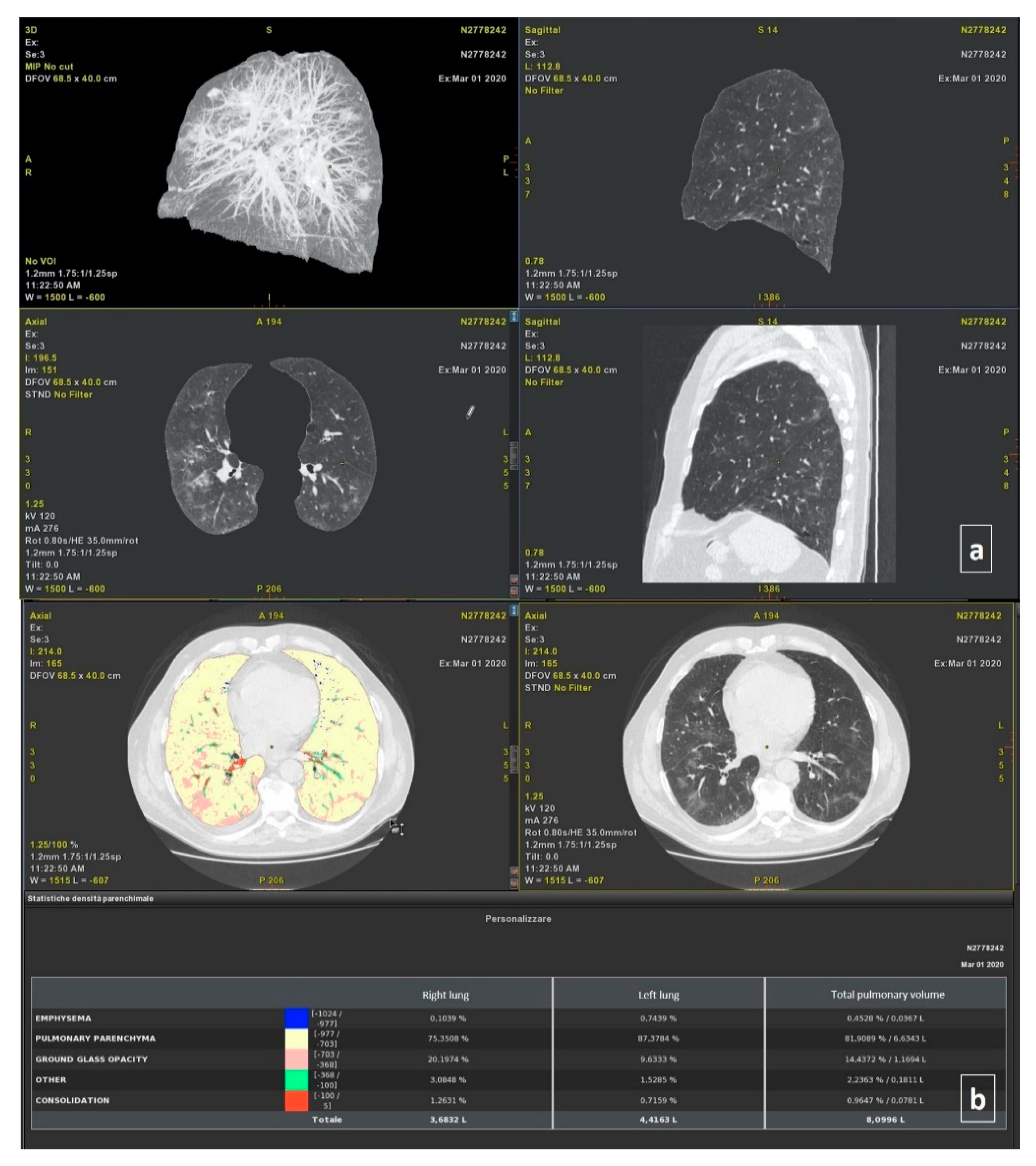 free dicom viewer postero-central free dicom viewer postero-central