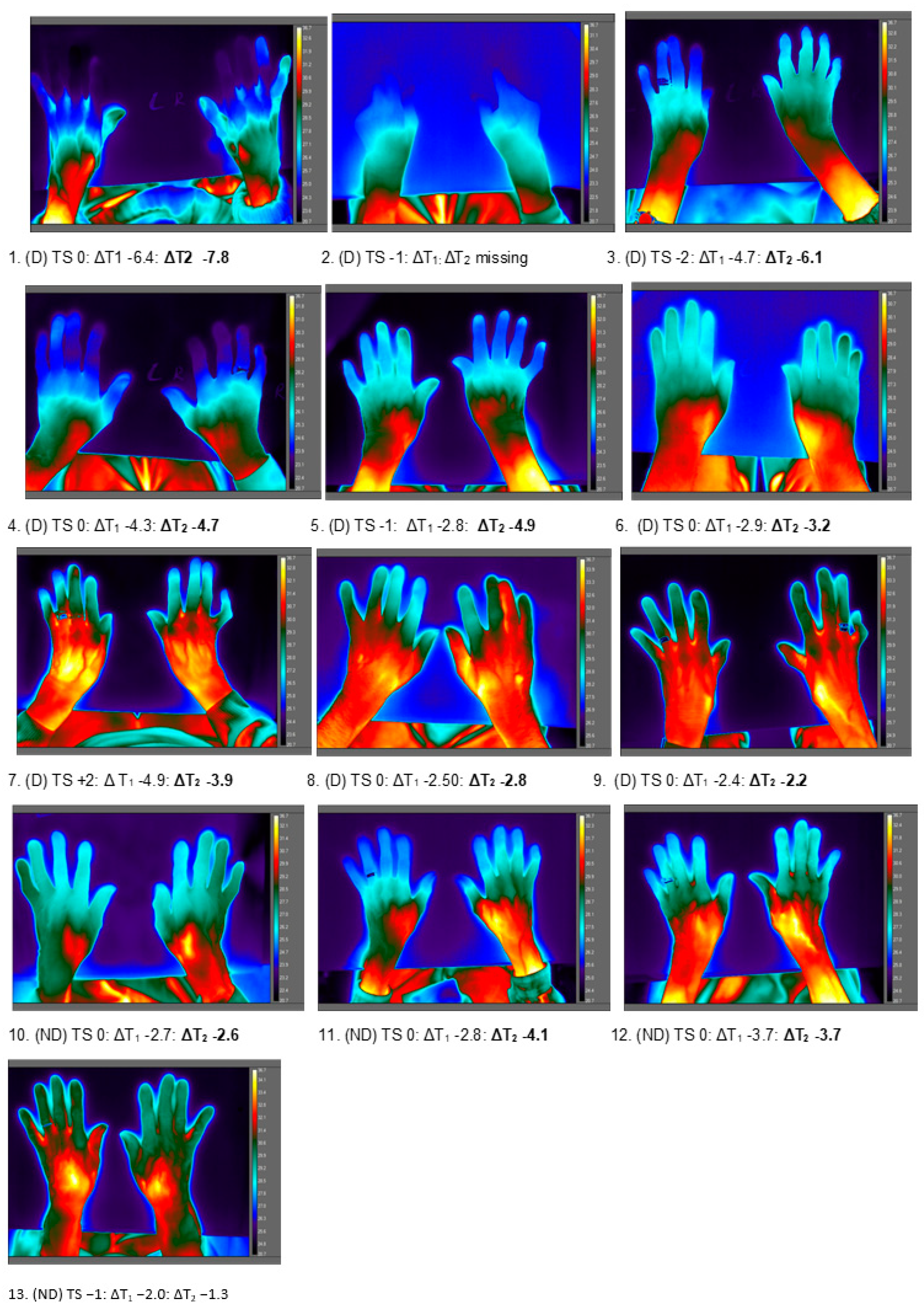 Ijerph Free Full Text Thermal Sensation In Older People With And Without Dementia Living In Residential Care New Assessment Approaches To Thermal Comfort Using Infrared Thermography Html