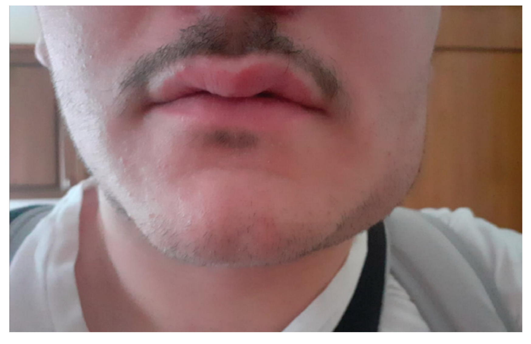 Ijerph 17 07365 g005