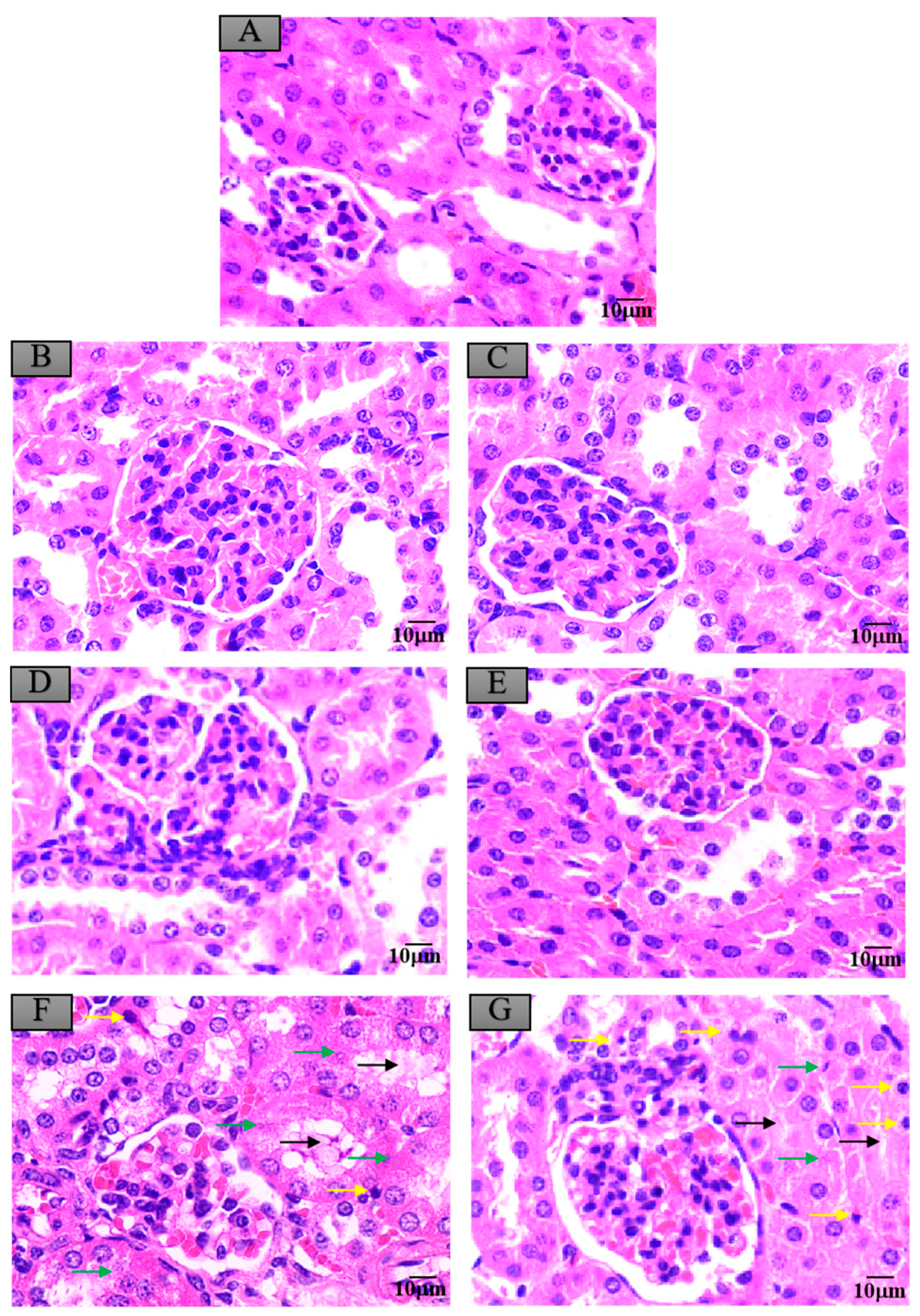 Ijerph 17 07882 g005