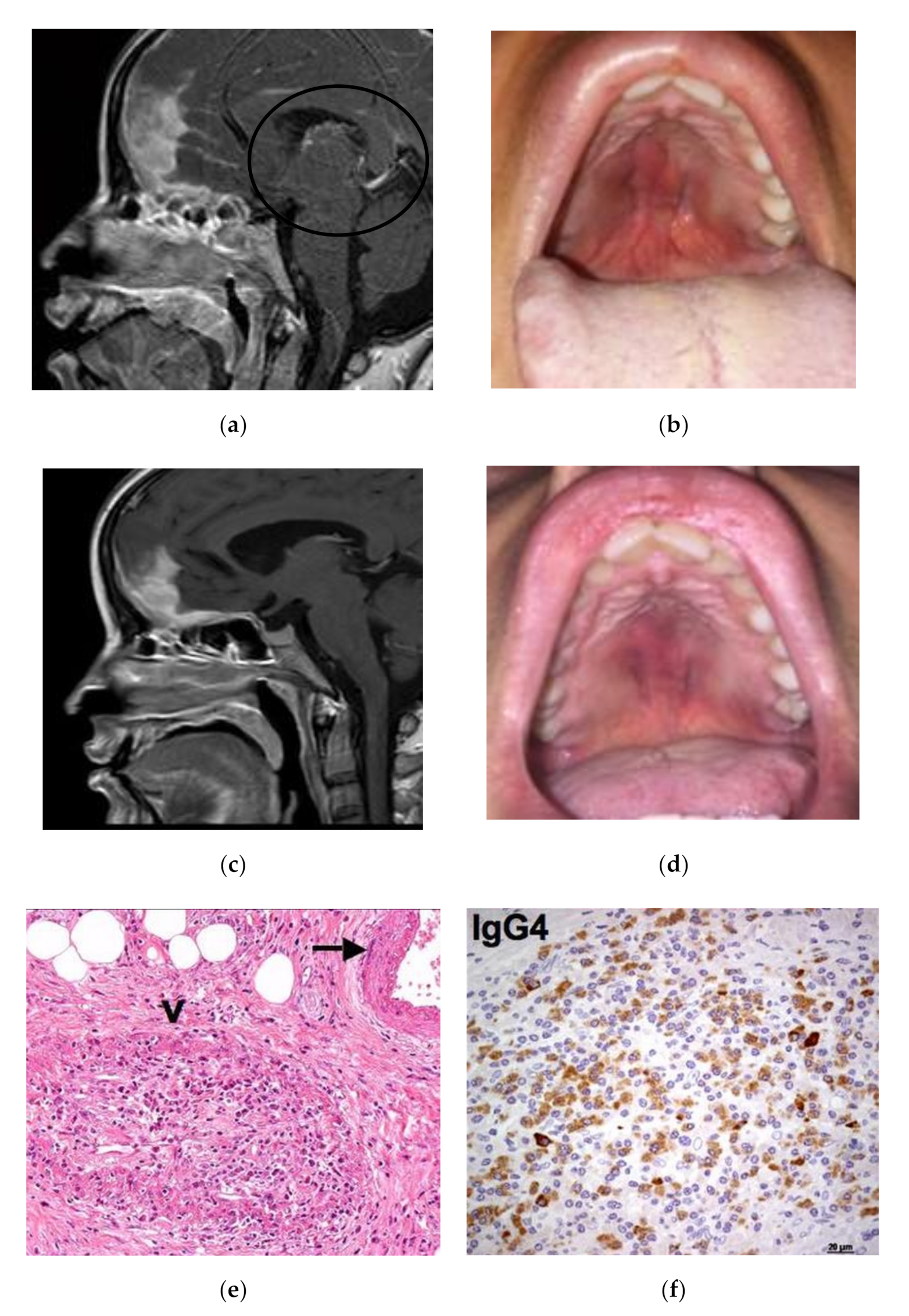 Ijerph 17 08179 g001