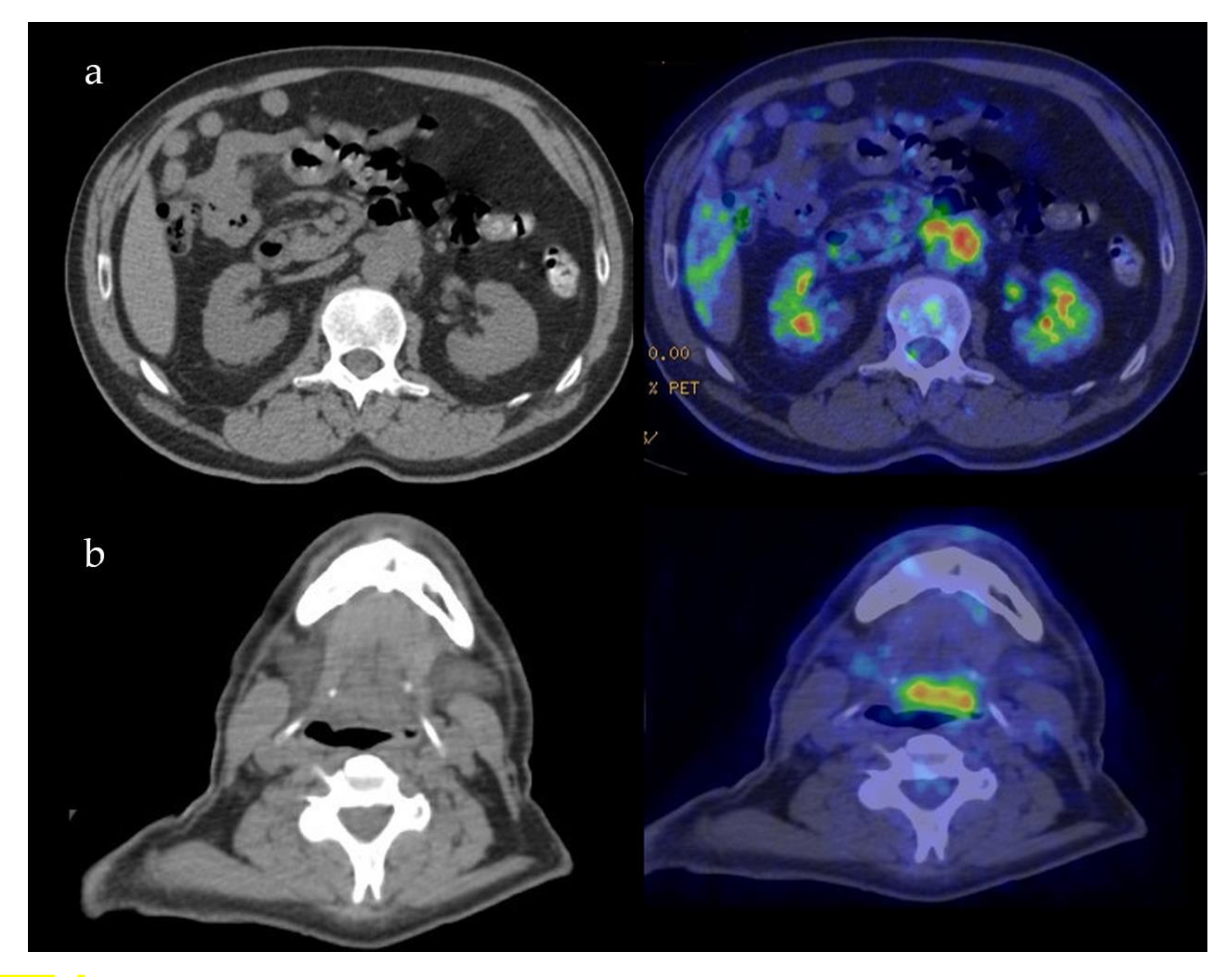 Ijerph 17 08179 g004