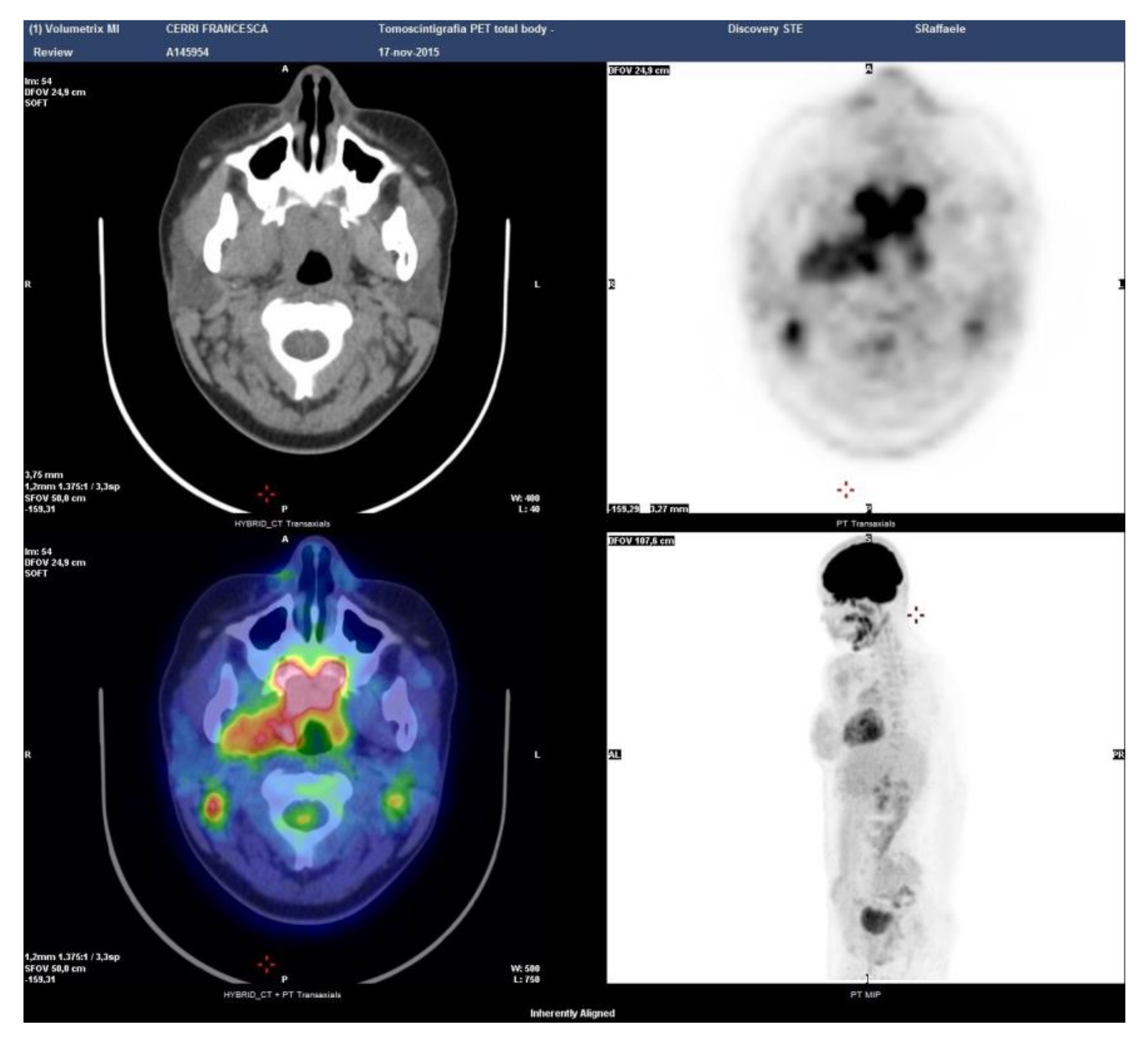 Ijerph 17 08179 g005