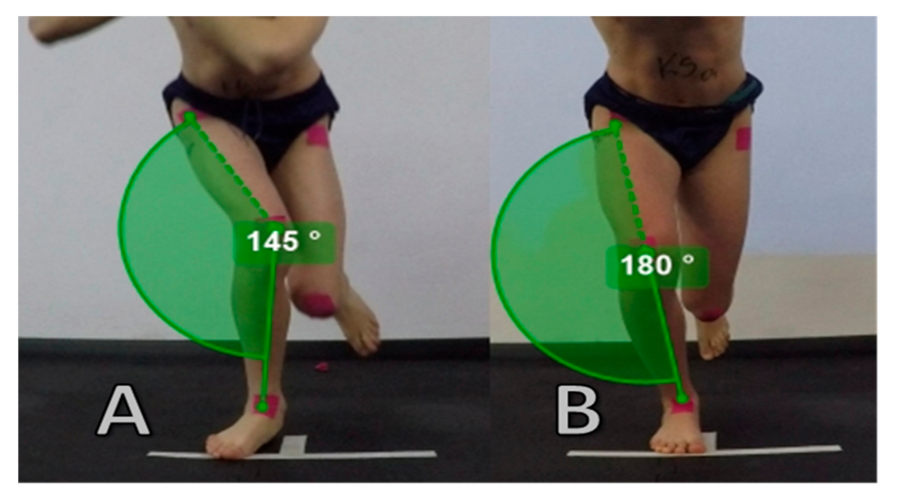 IJERPH Free Full-Text Dynamic Knee Valgus in Single-Leg Movement Tasks photo