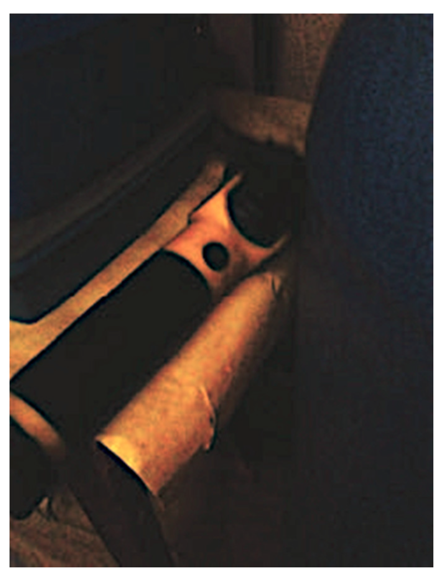 Ijerph 17 08276 g006 Ijerph 17 08276 g006