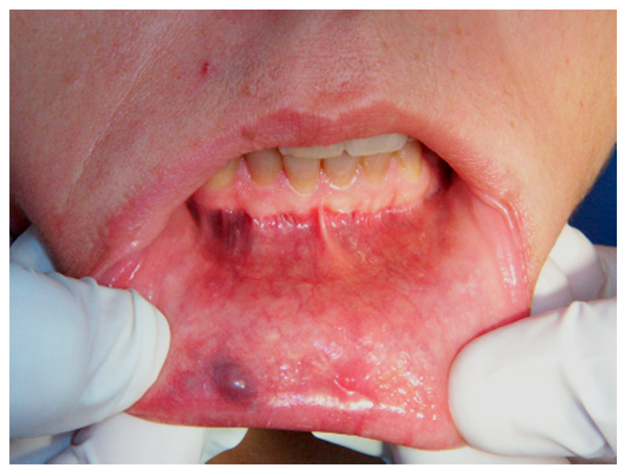 Ijerph 17 08665 g001