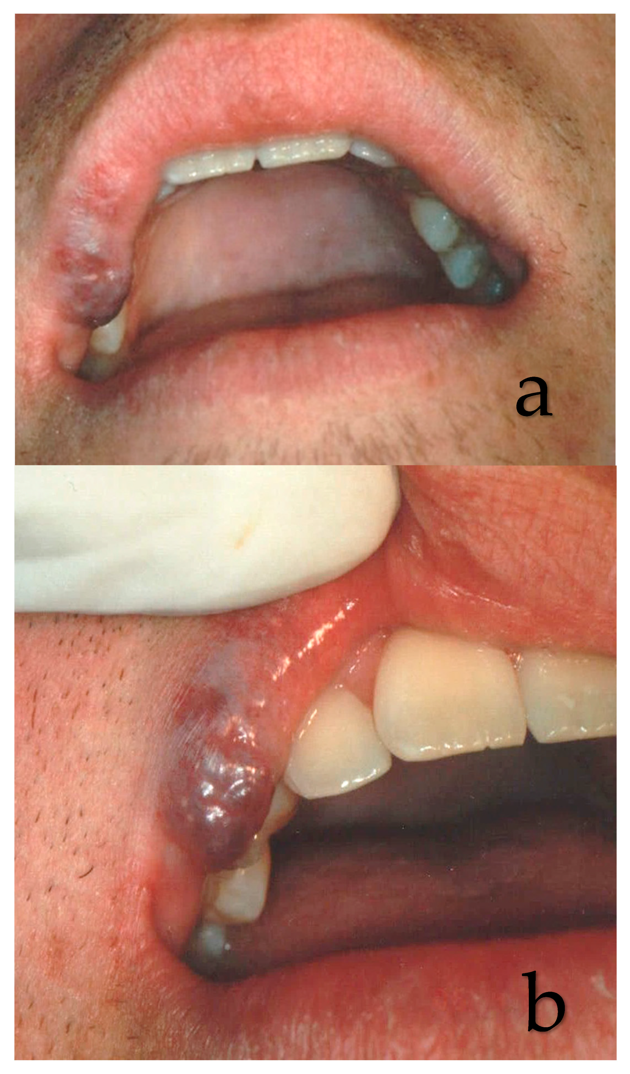 Ijerph 17 08665 g004