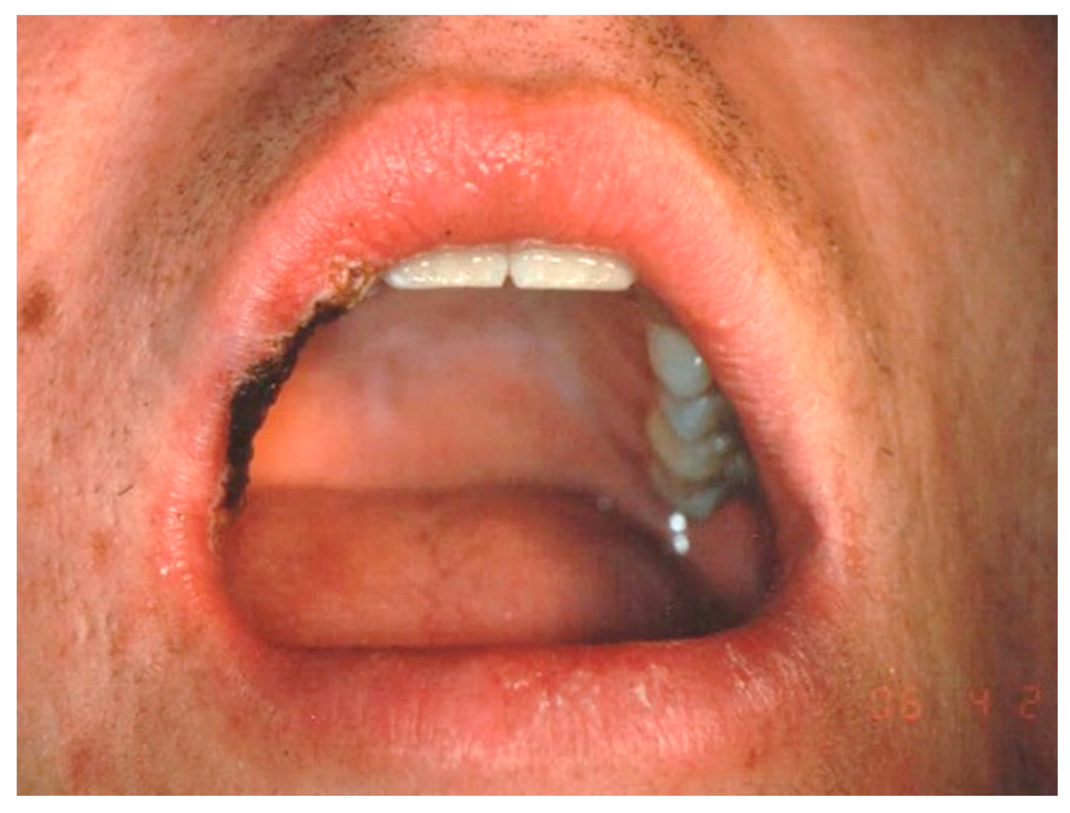 Ijerph 17 08665 g006