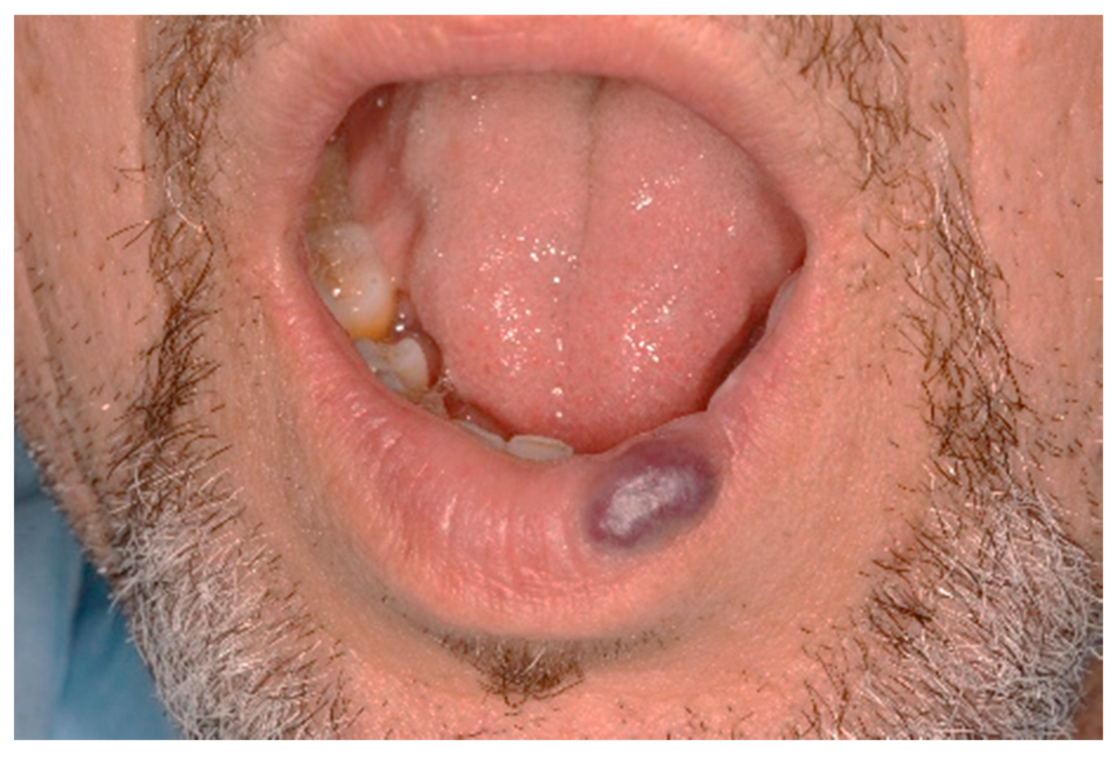 Ijerph 17 08665 g007