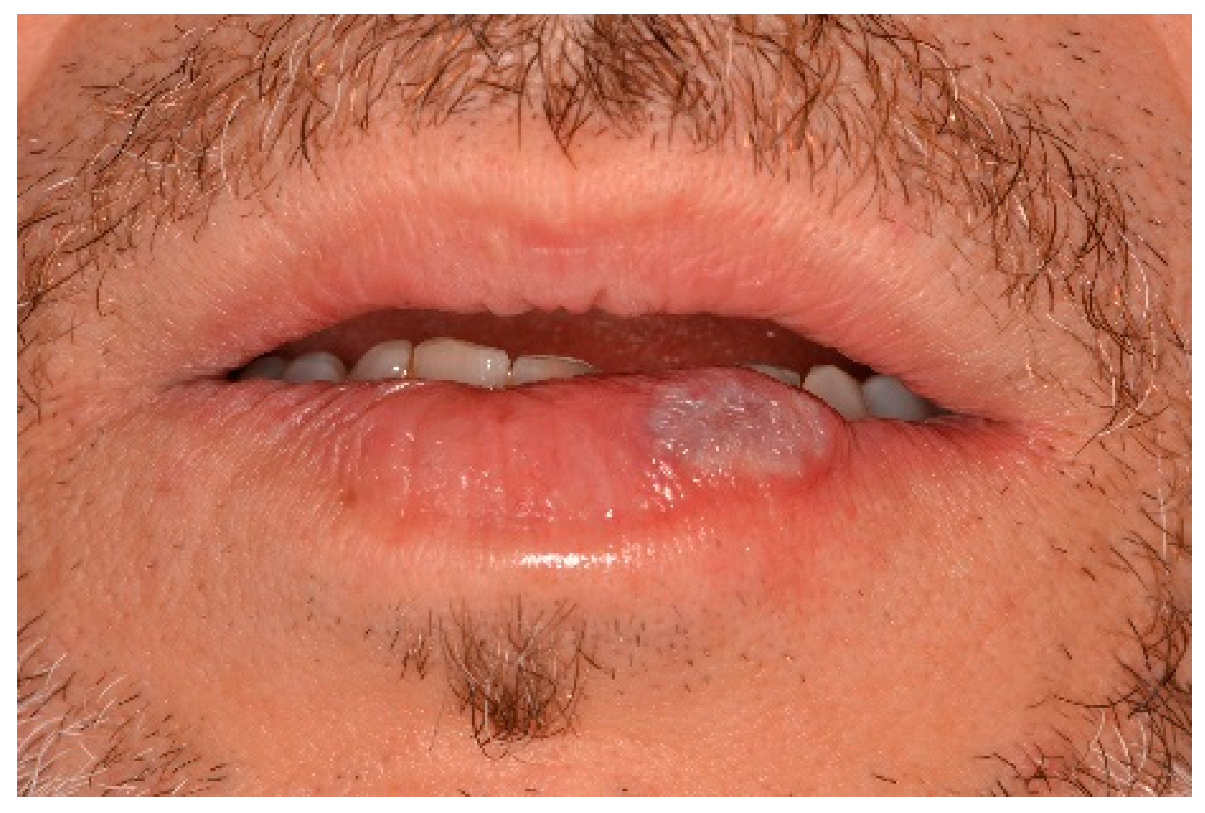 Ijerph 17 08665 g008