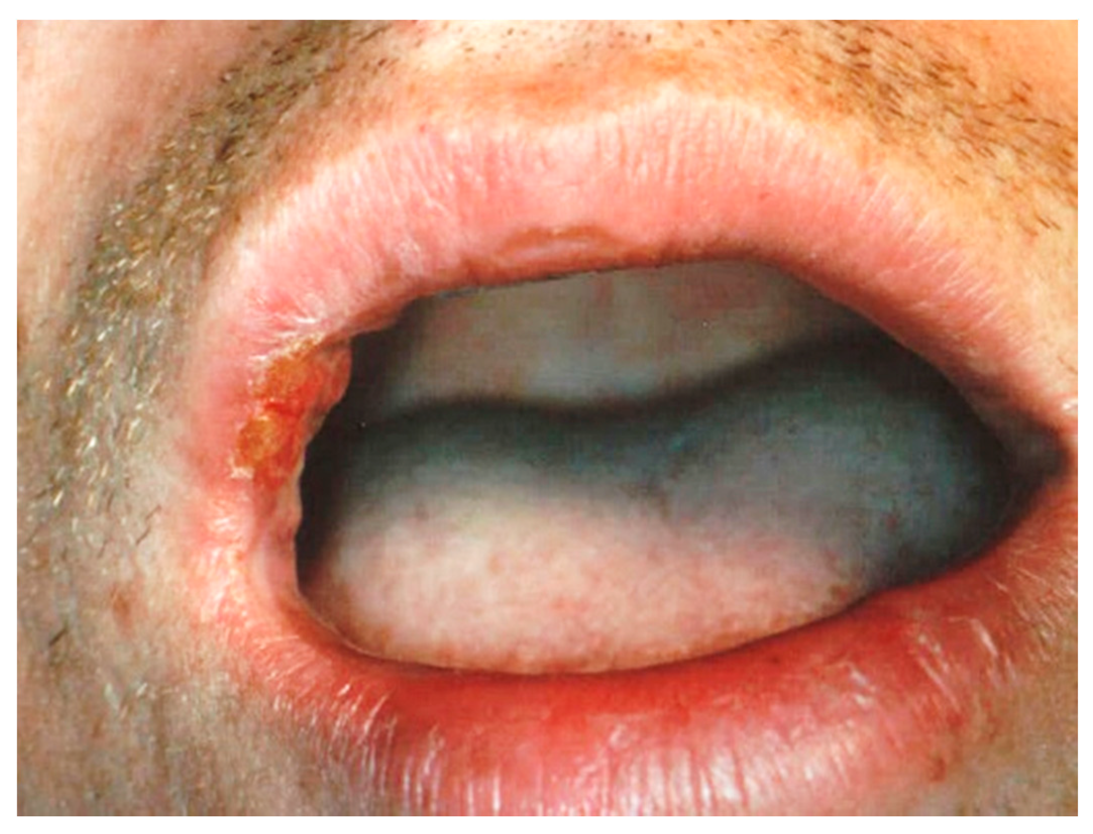 Ijerph 17 08665 g012