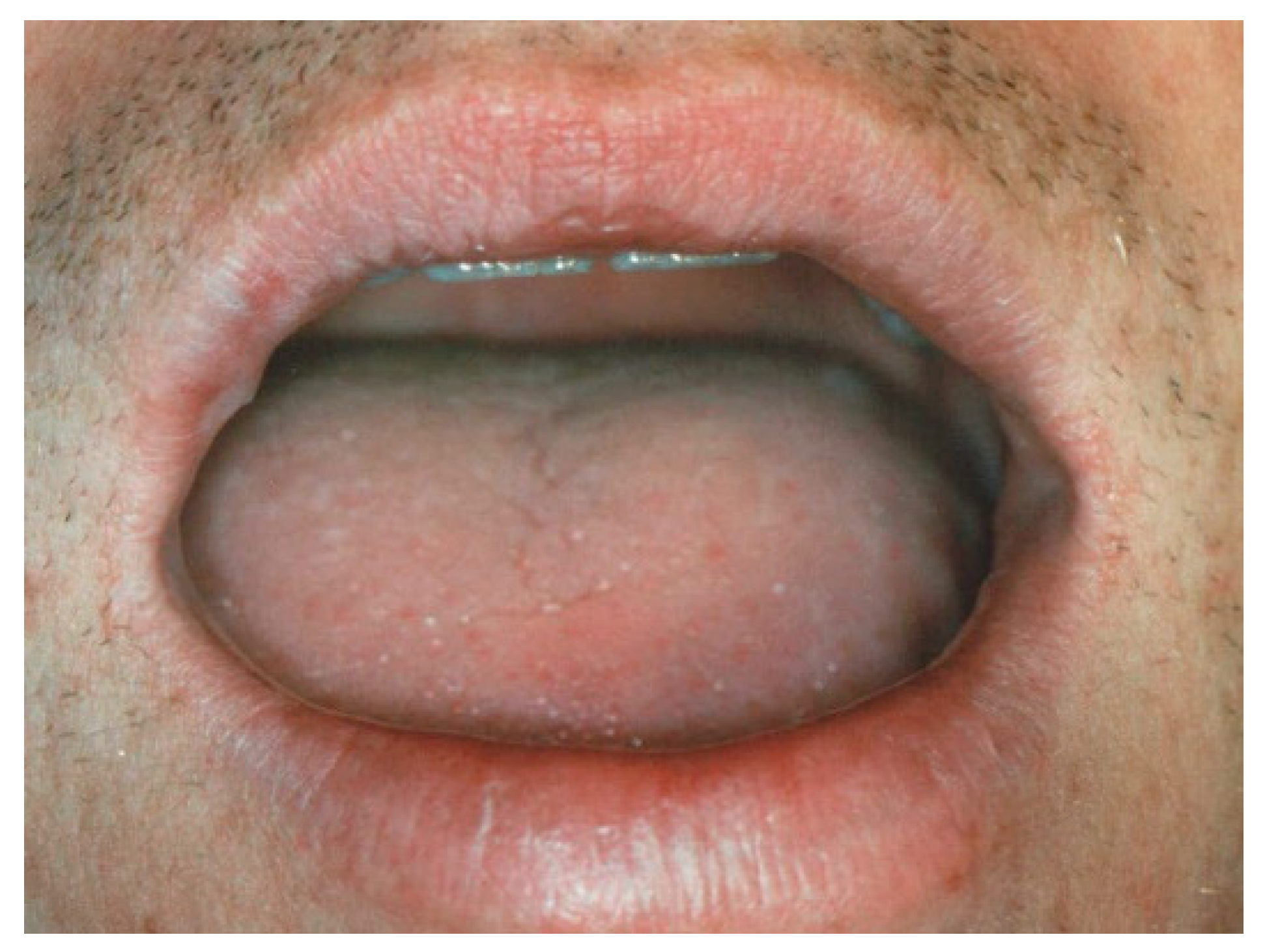 Ijerph 17 08665 g013