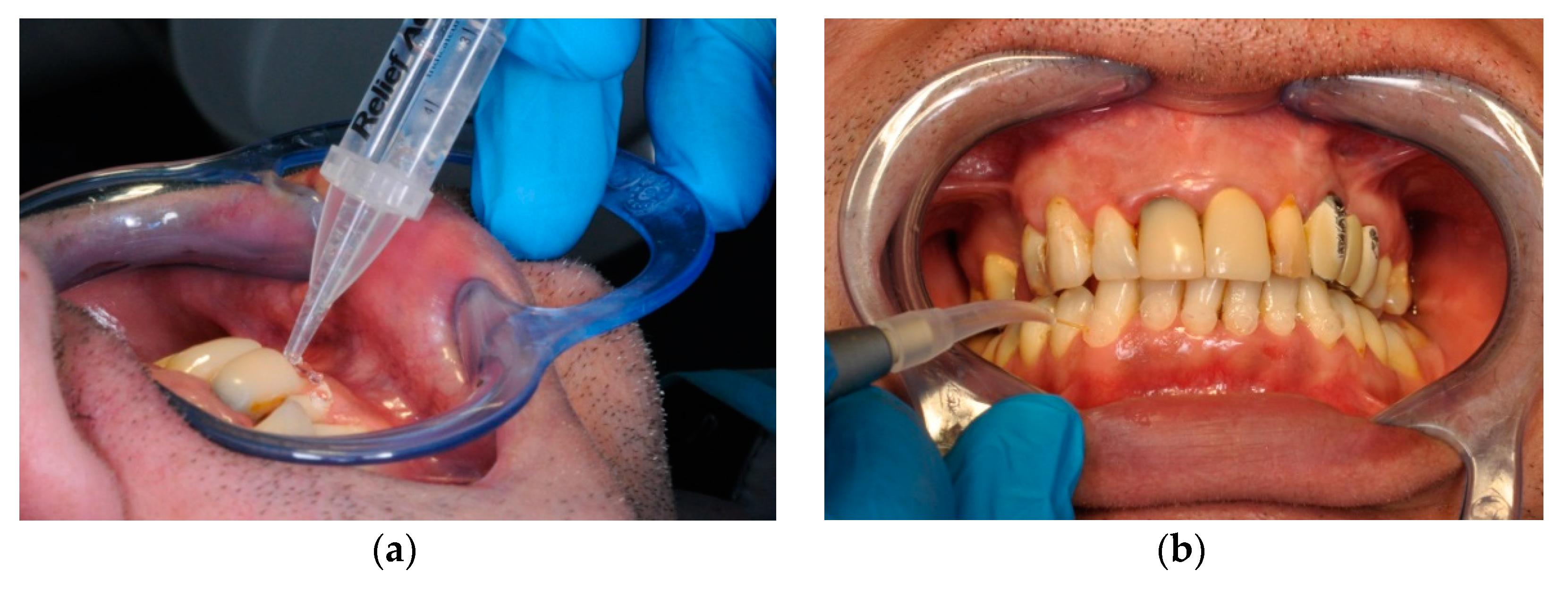 Ijerph 17 08787 g002