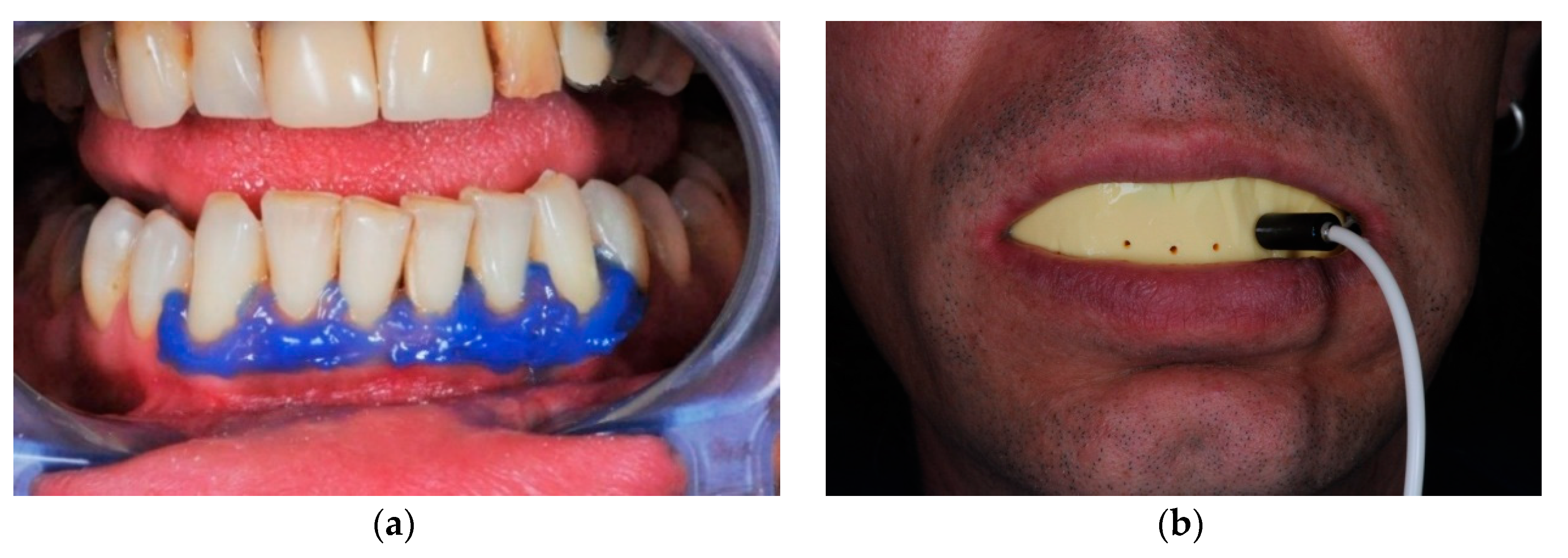 Ijerph 17 08787 g004