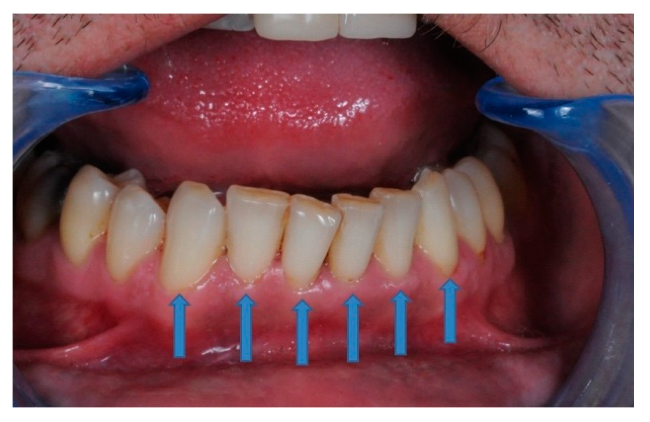 Ijerph 17 08787 g006