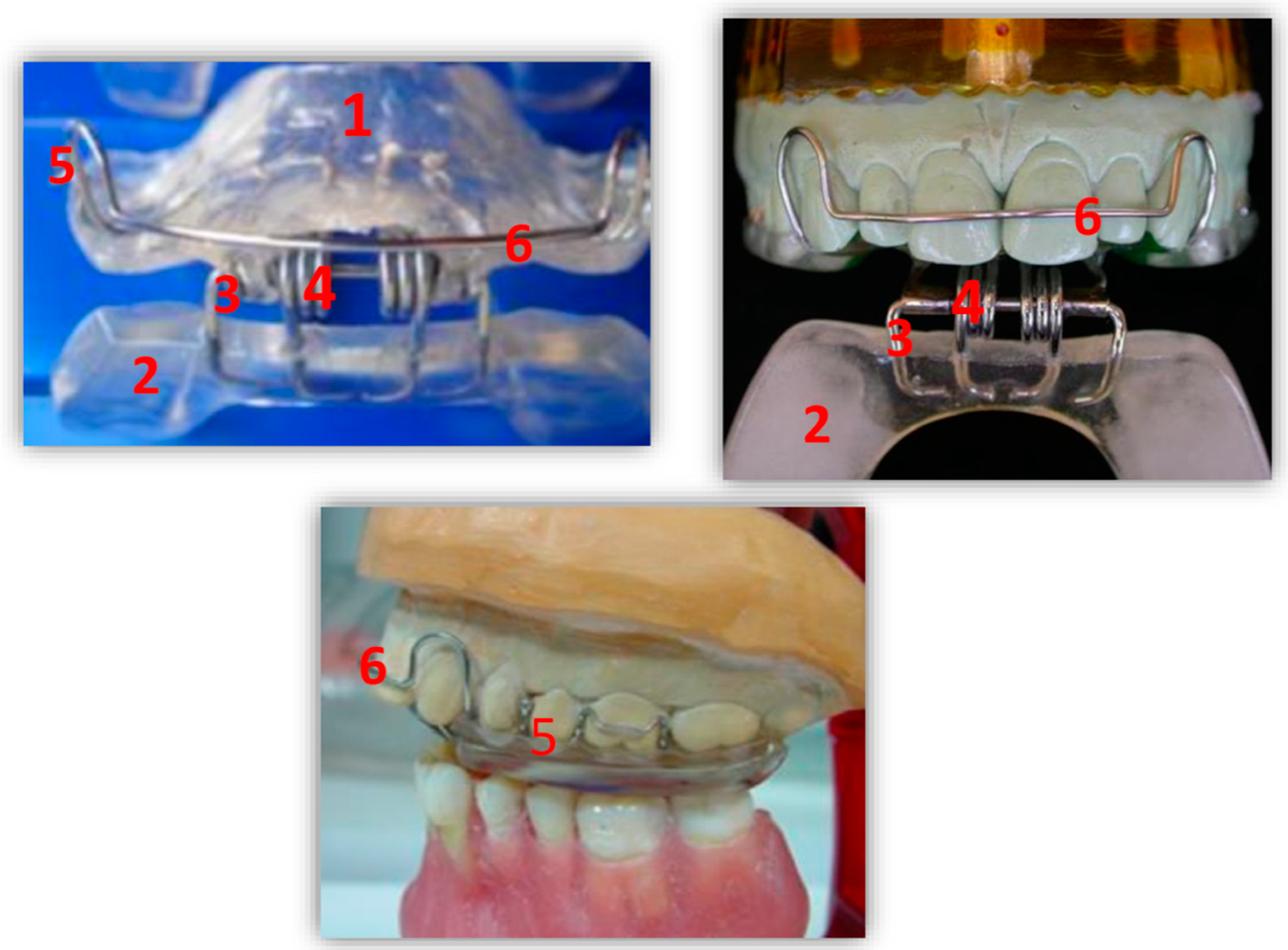 Ijerph 17 09057 g001 Ijerph 17 09057 g001