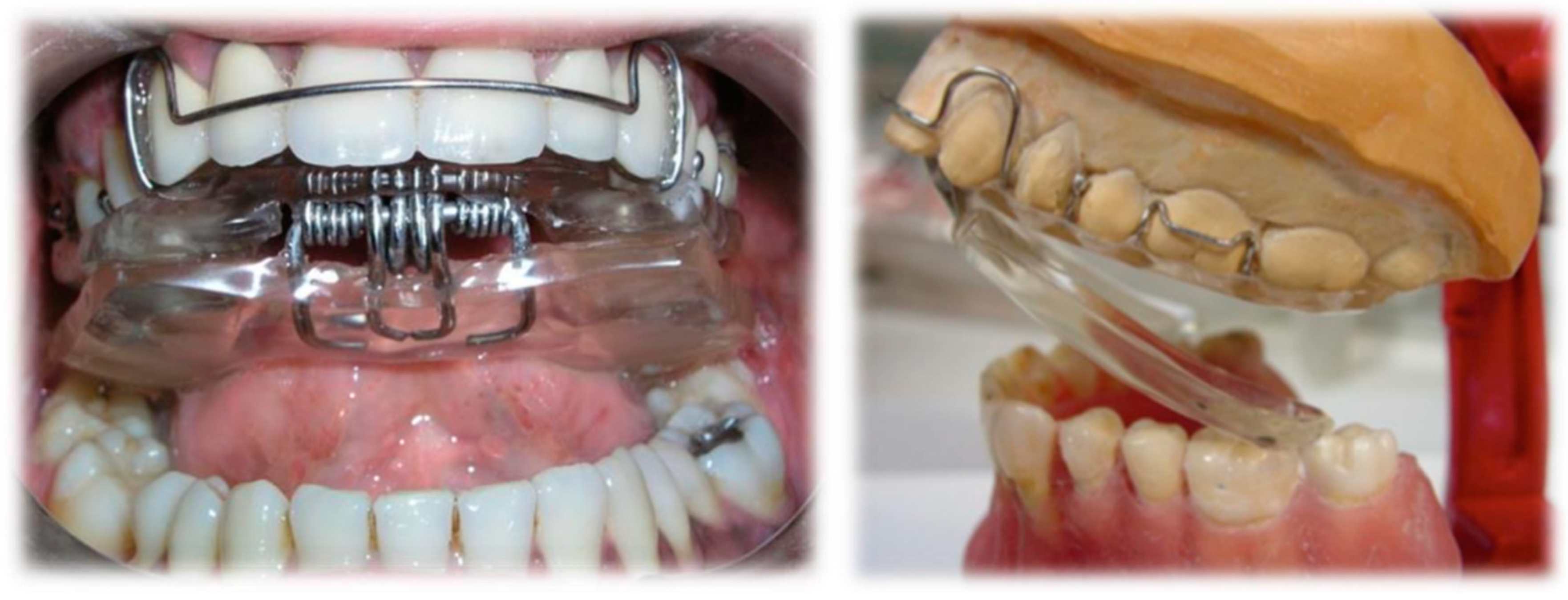 Ijerph 17 09057 g002 Ijerph 17 09057 g002