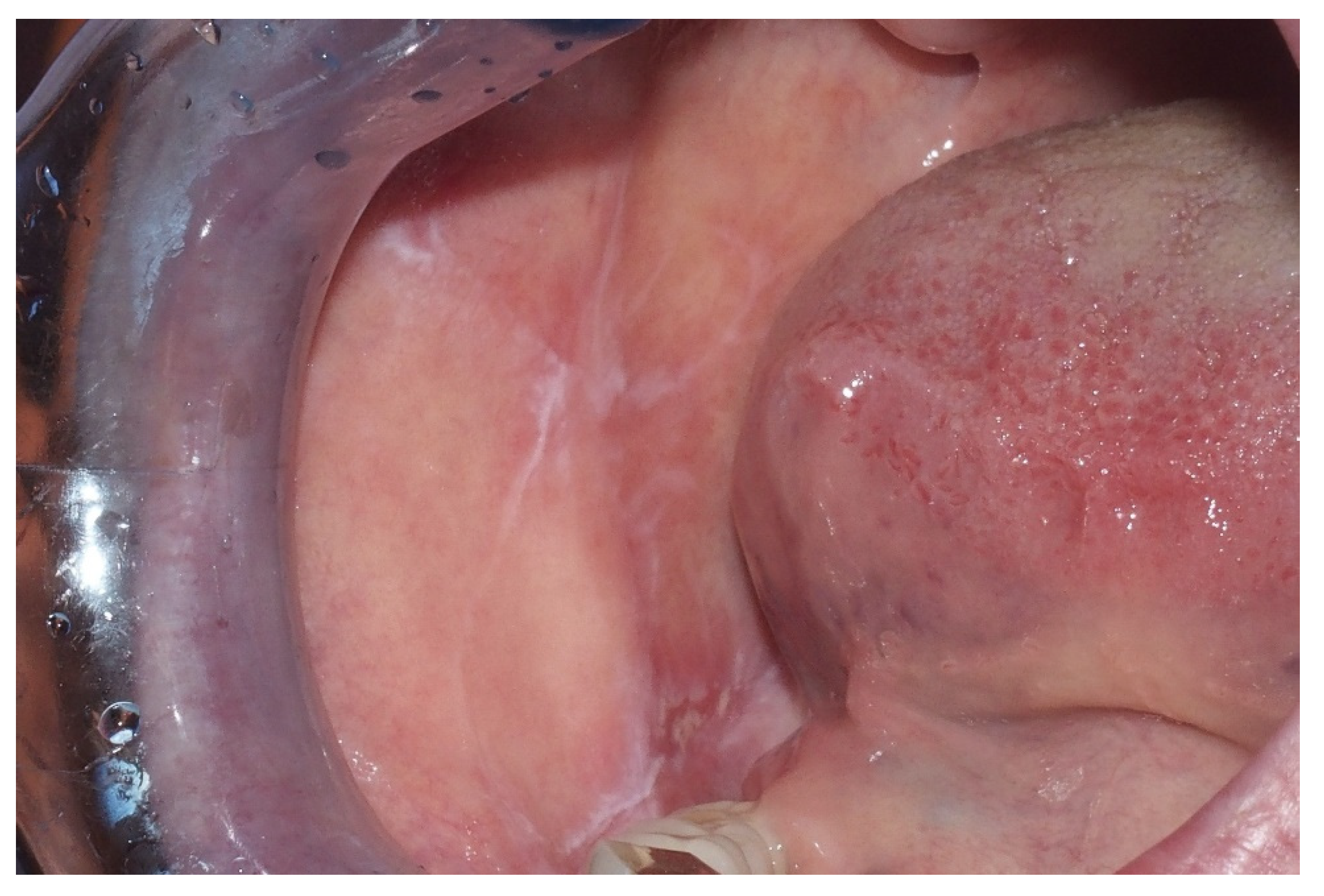 Ijerph 17 09160 g003