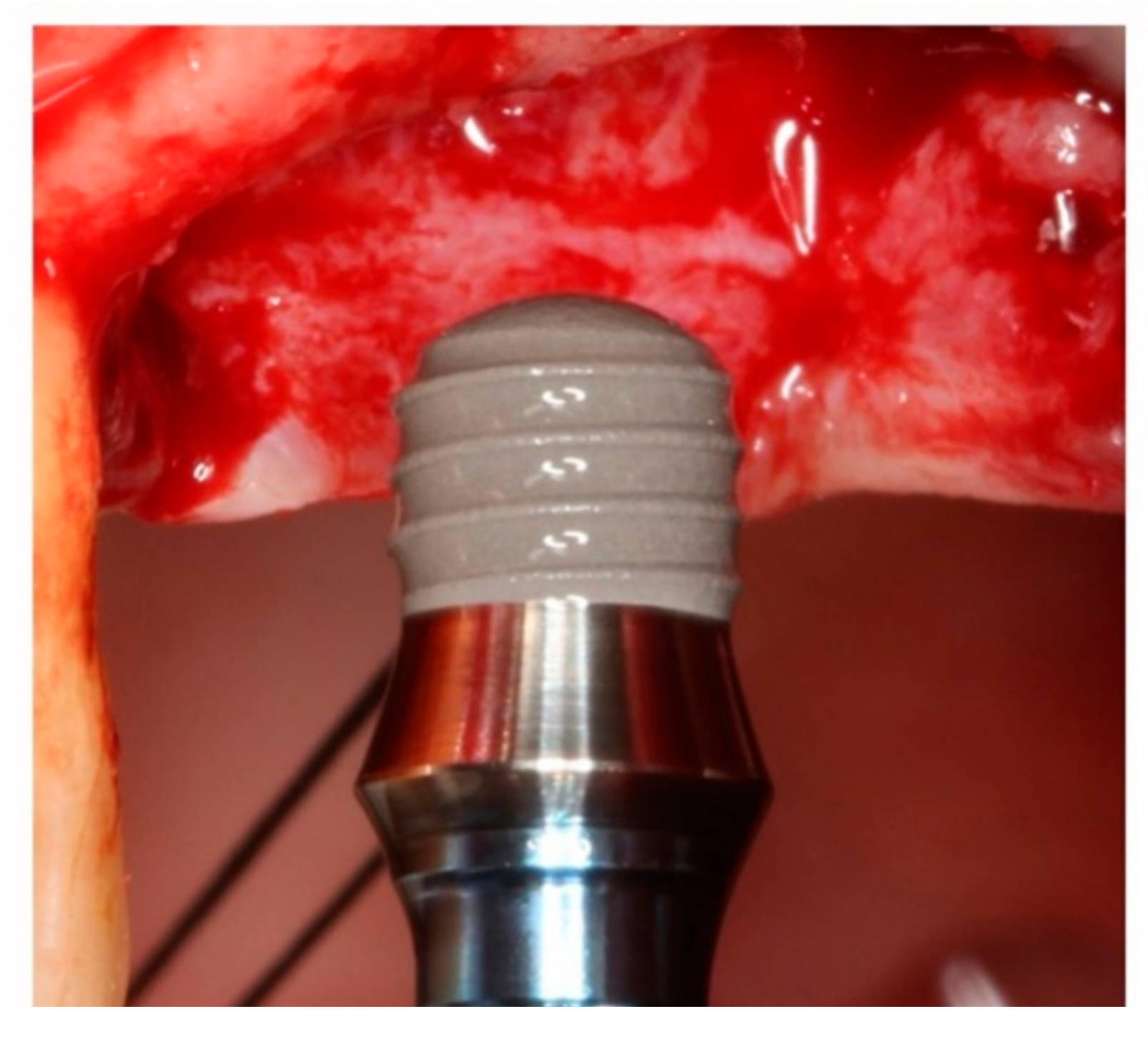 Ijerph 17 09278 g001