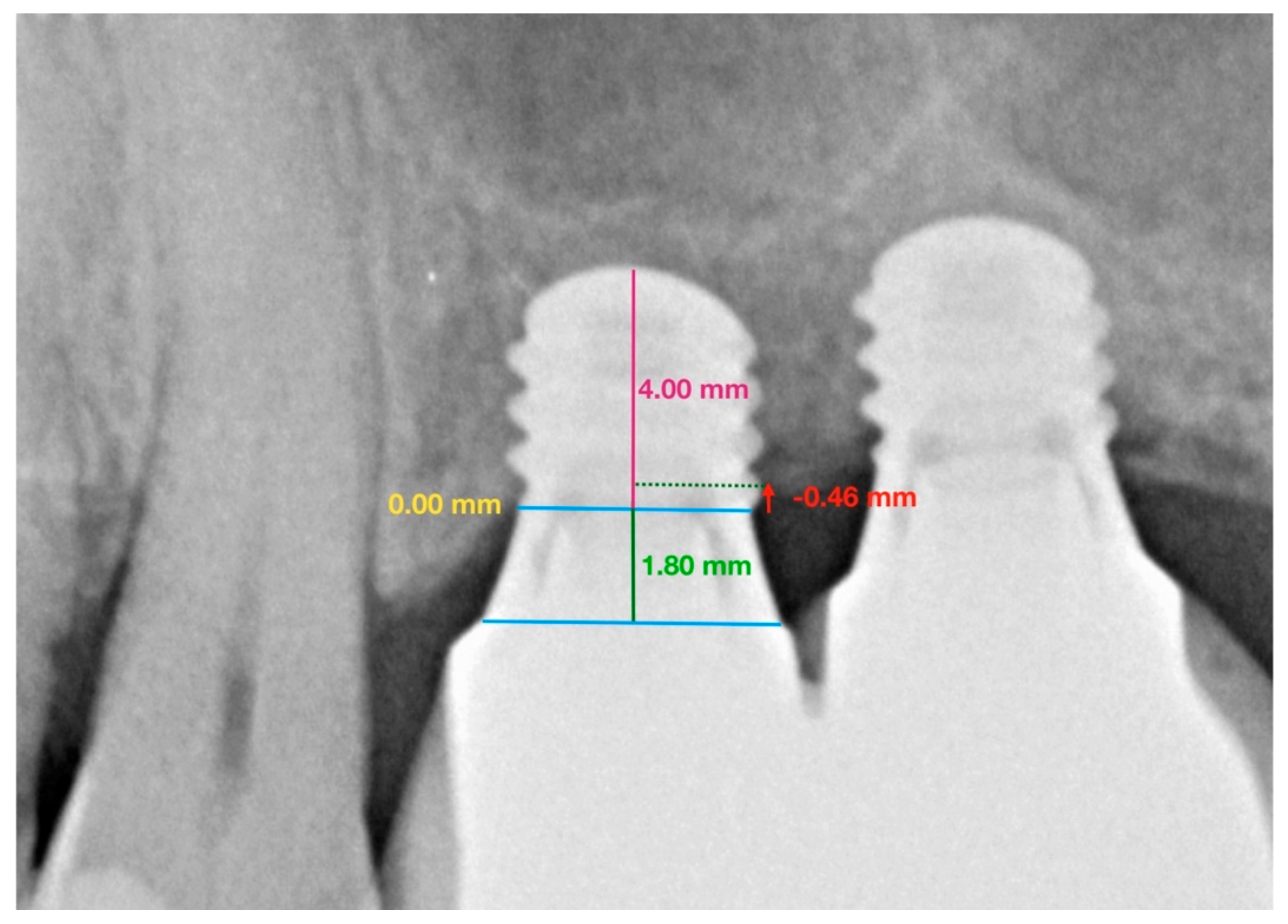 Ijerph 17 09278 g002