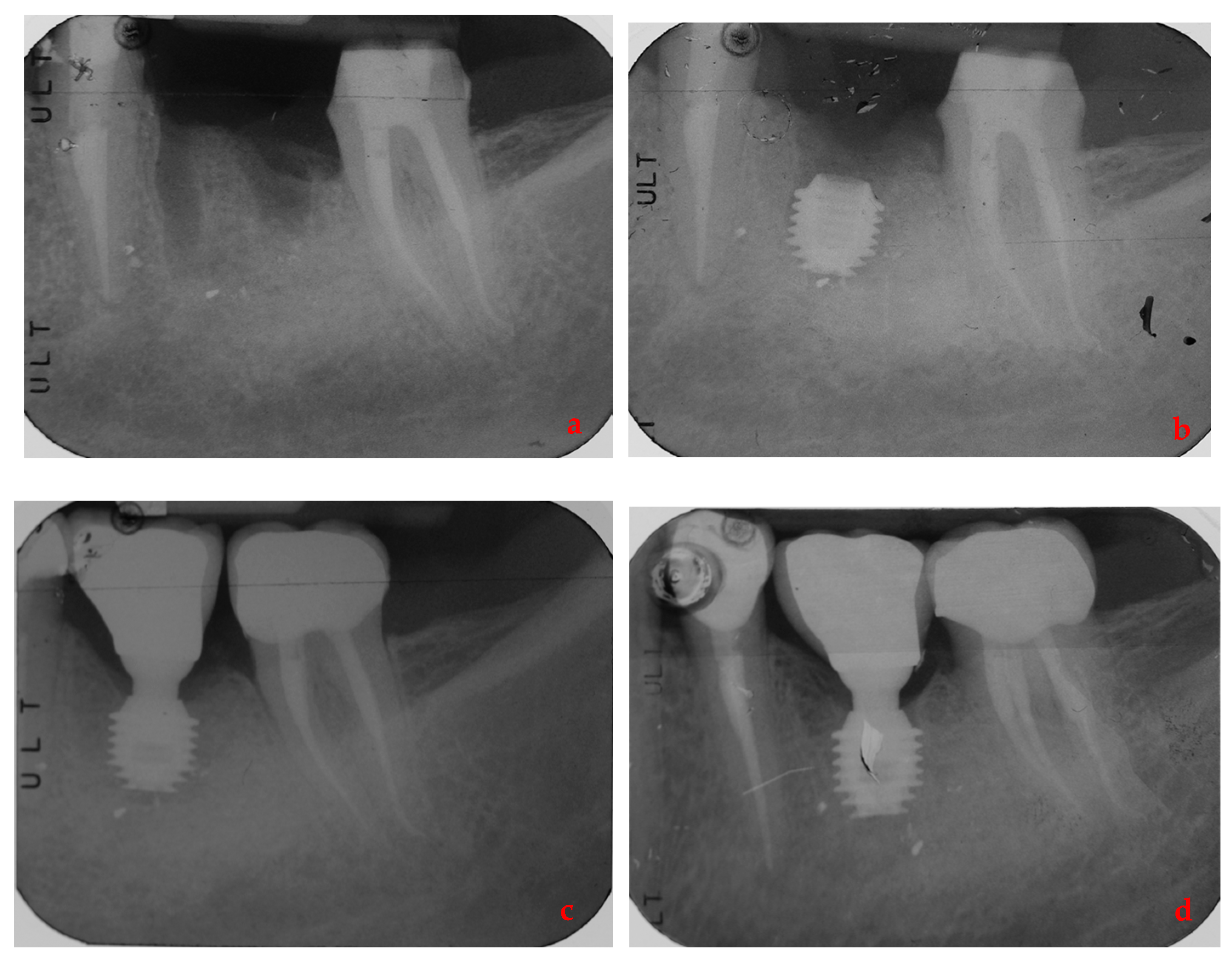 Ijerph 17 09354 g002 Ijerph 17 09354 g002