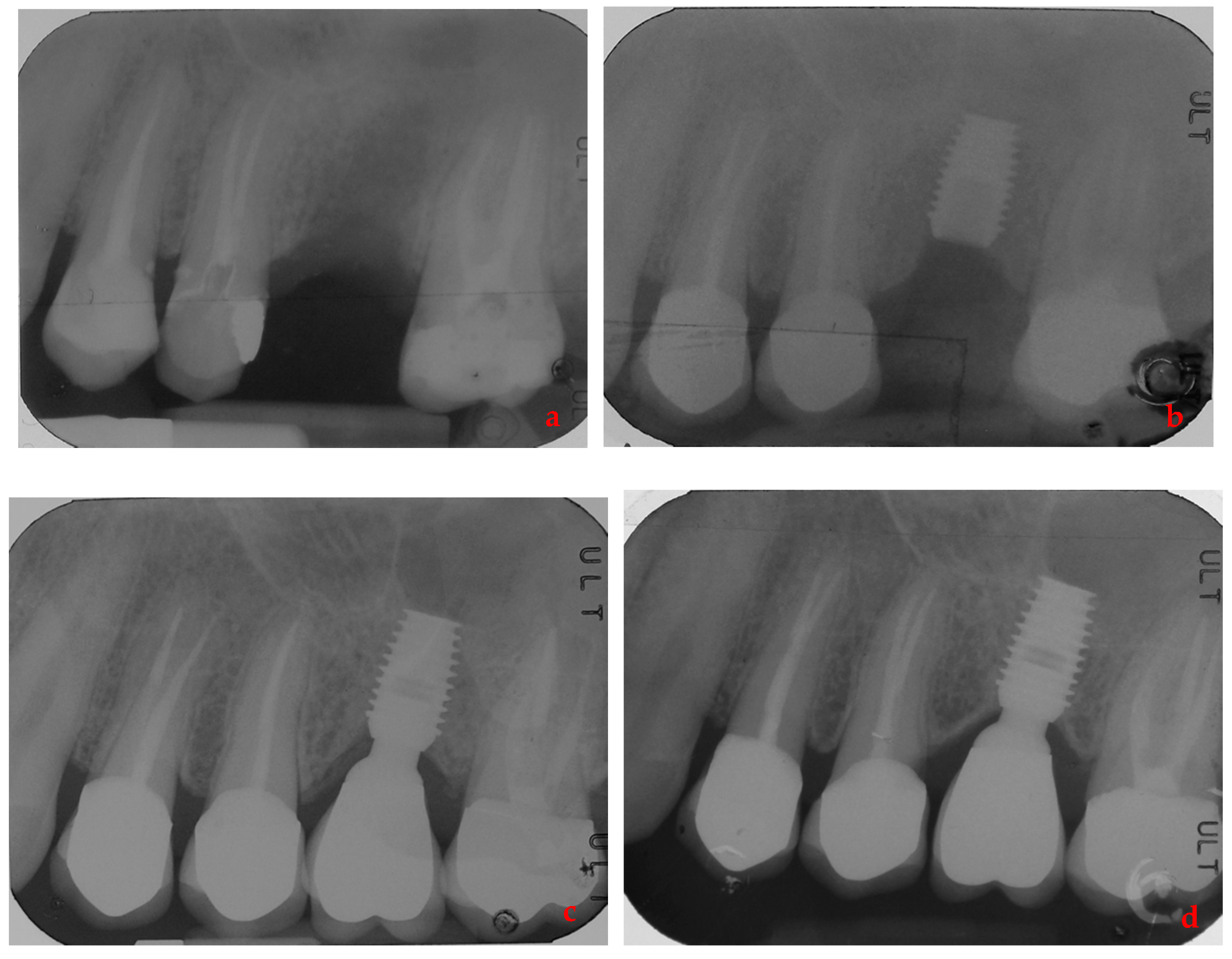 Ijerph 17 09354 g003 Ijerph 17 09354 g003