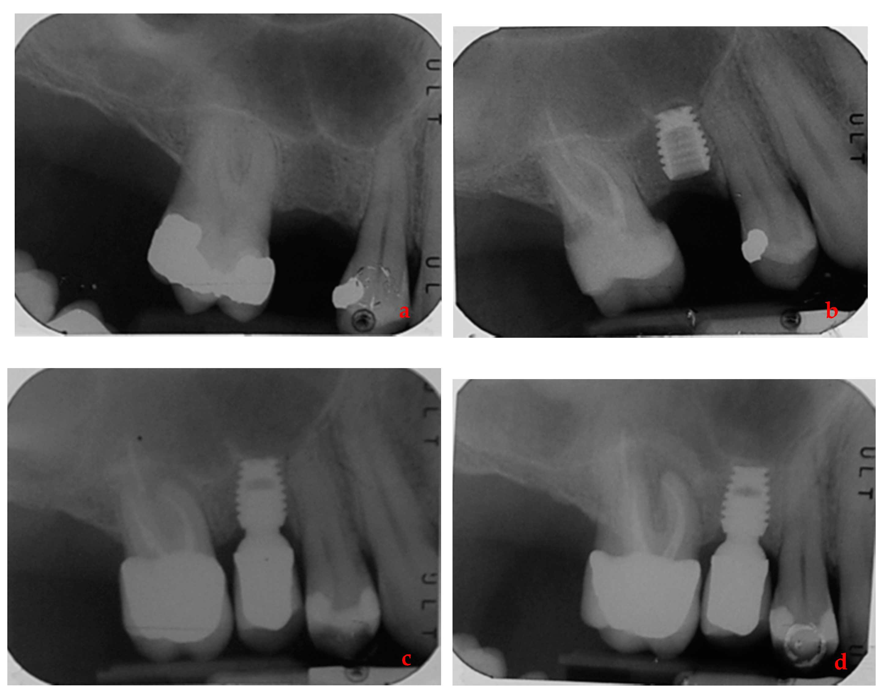 Ijerph 17 09354 g004 Ijerph 17 09354 g004