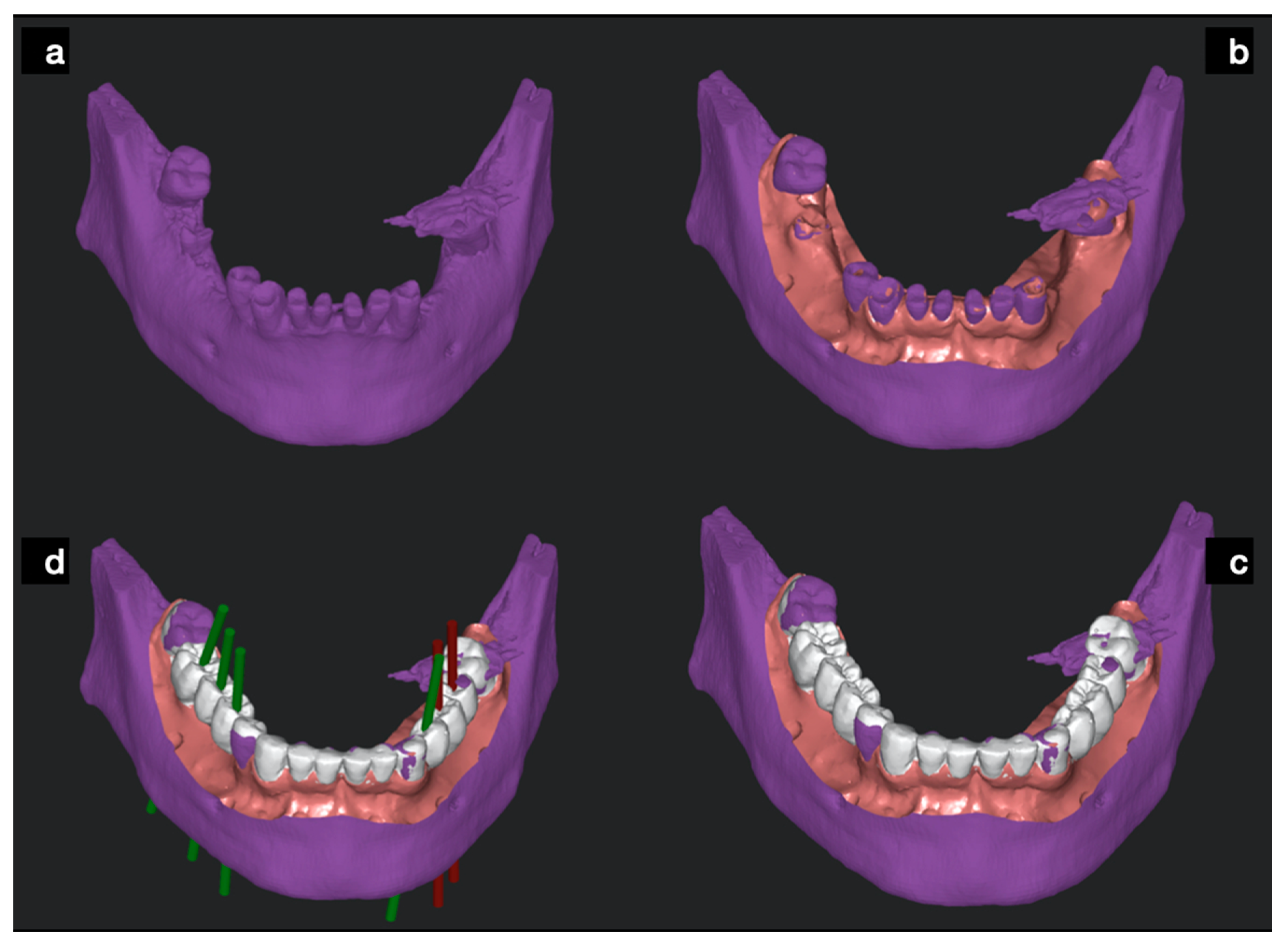 Ijerph 17 09358 g003 Ijerph 17 09358 g003