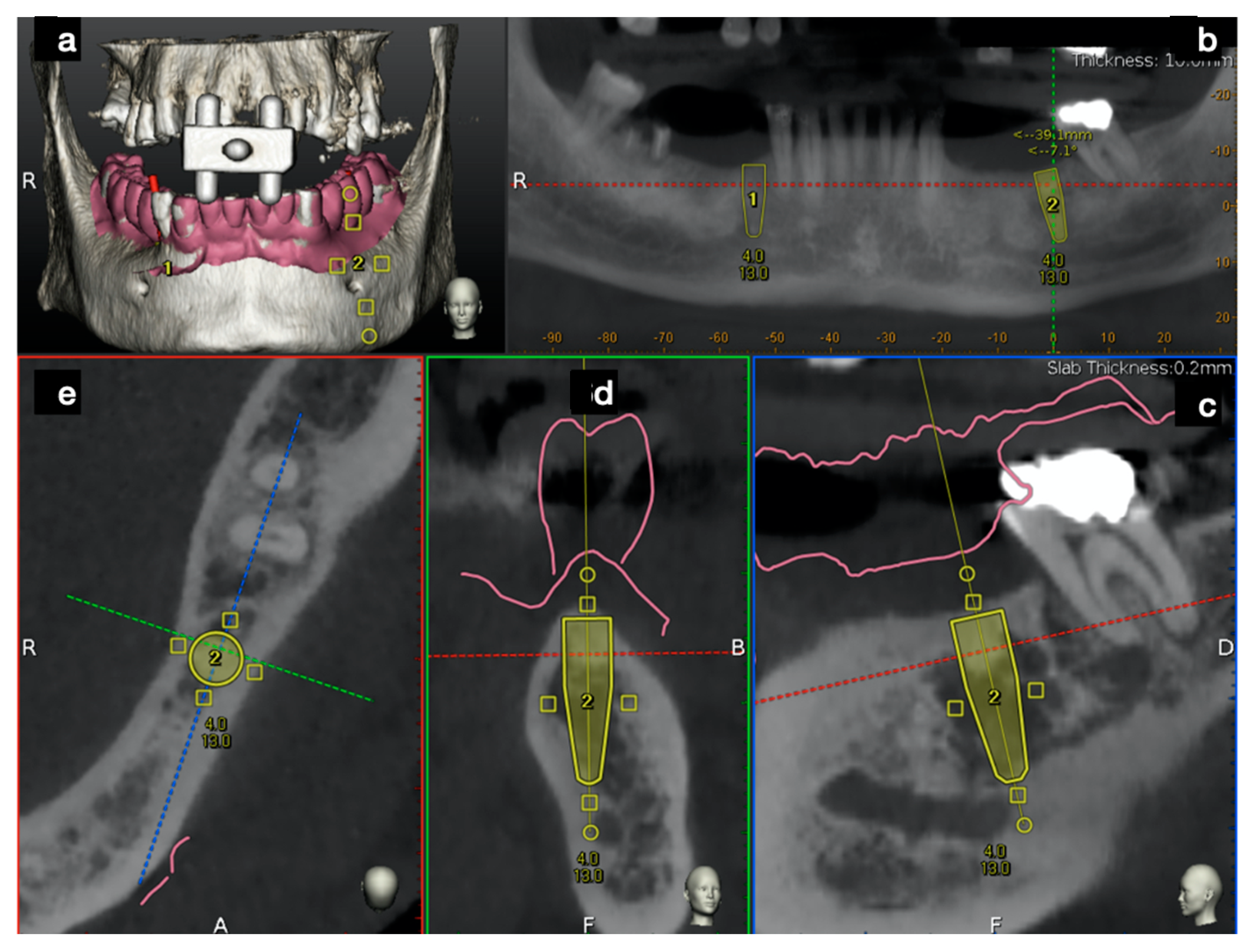 Ijerph 17 09358 g006 Ijerph 17 09358 g006
