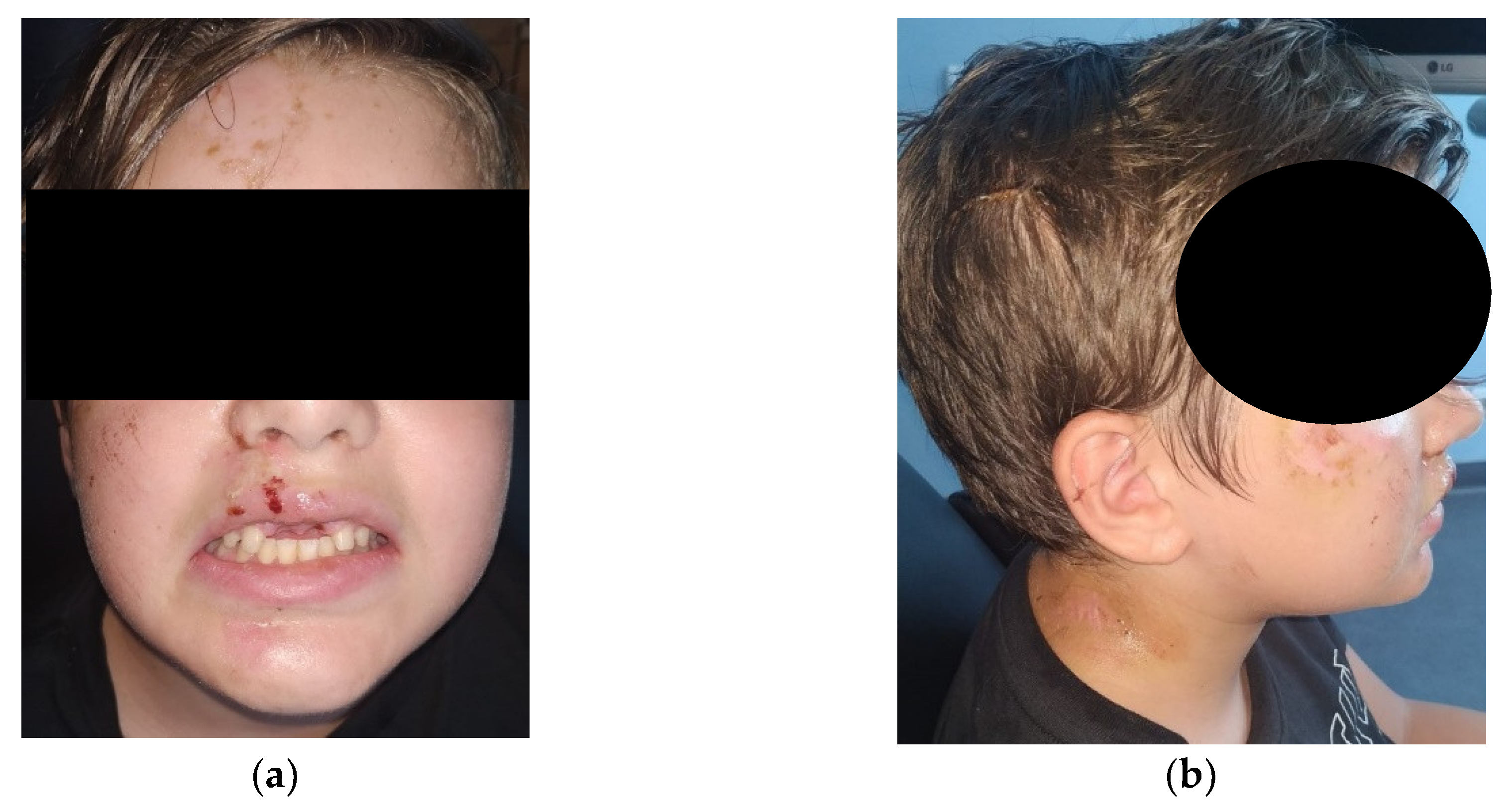 Ijerph 17 09423 g002 Ijerph 17 09423 g002