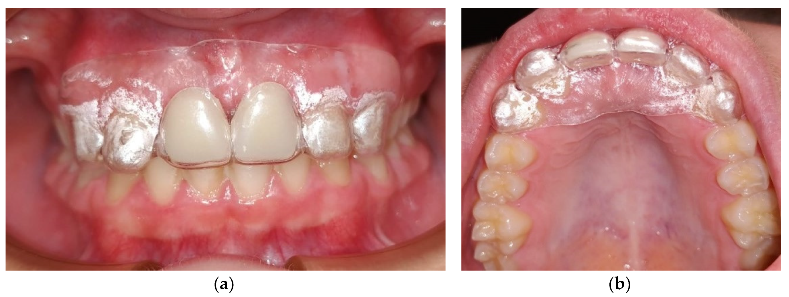 Ijerph 17 09423 g004 Ijerph 17 09423 g004