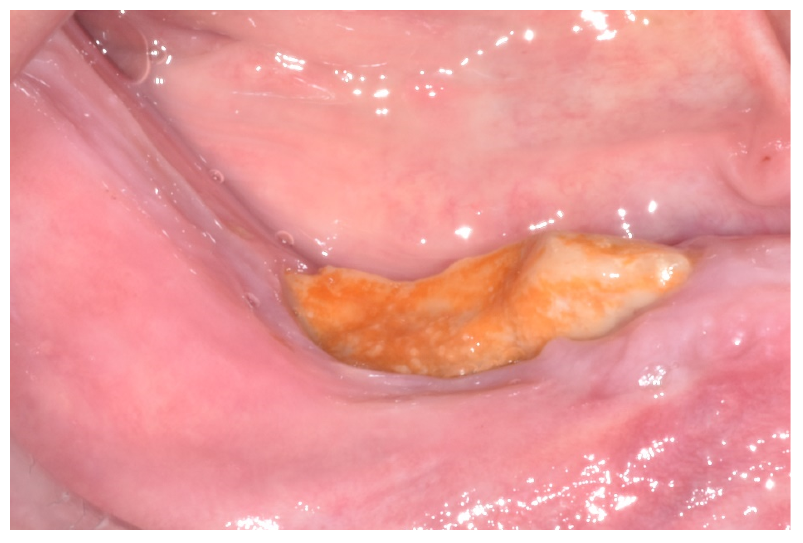 Ijerph 17 09509 g002 Ijerph 17 09509 g002