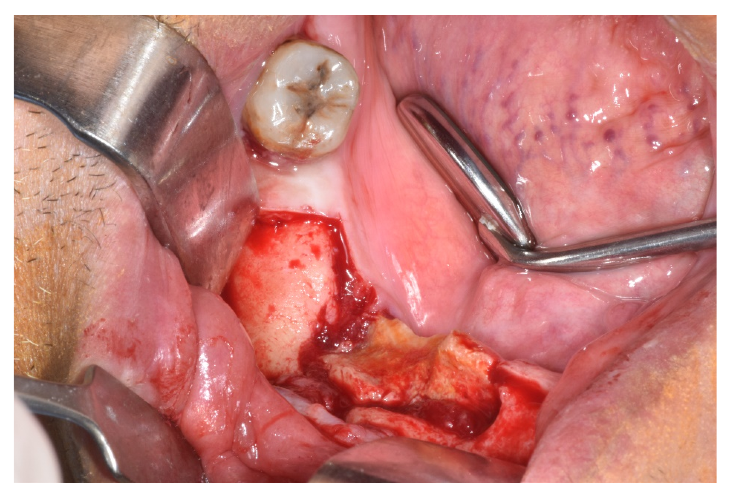 Ijerph 17 09509 g003 Ijerph 17 09509 g003