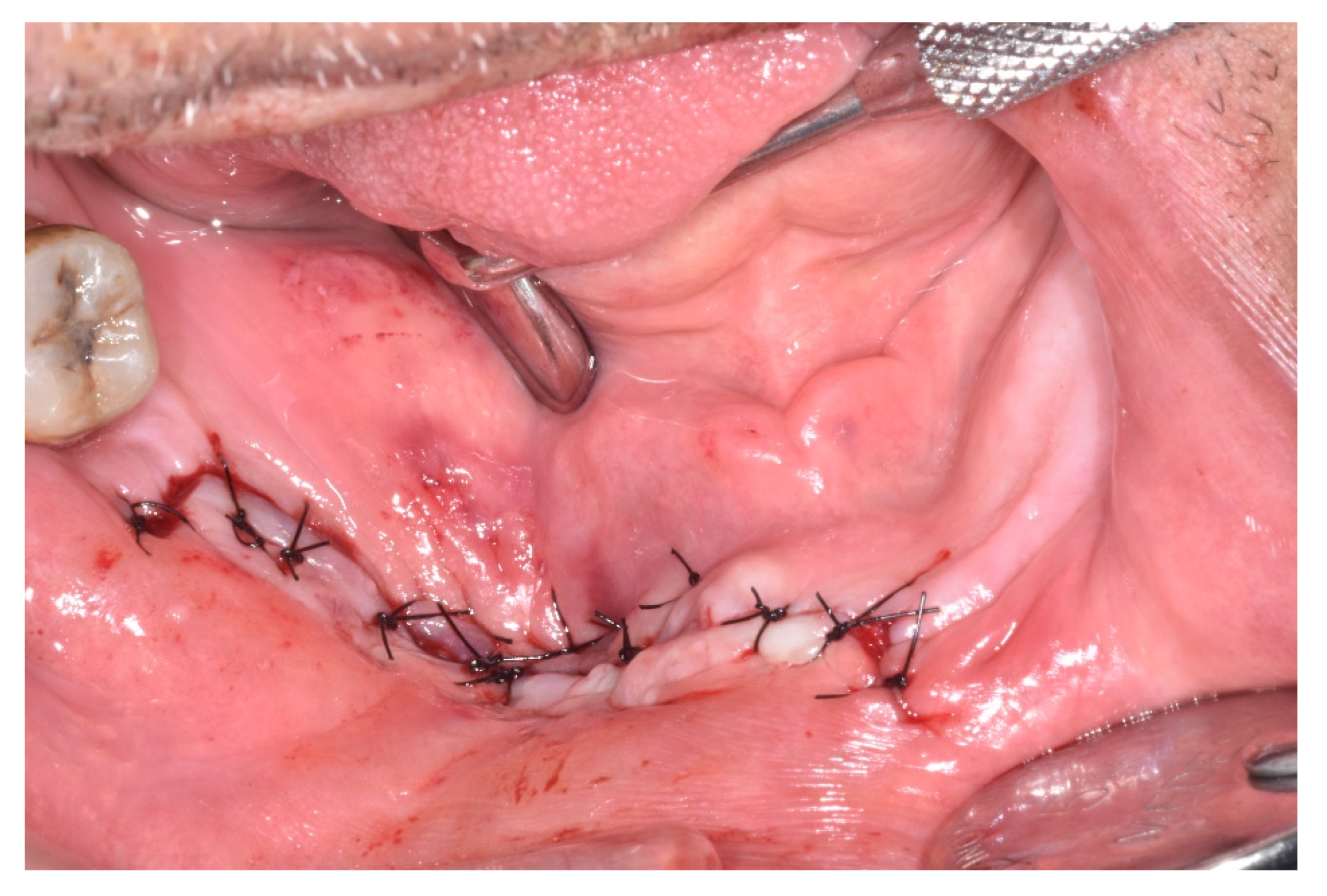 Ijerph 17 09509 g006 Ijerph 17 09509 g006