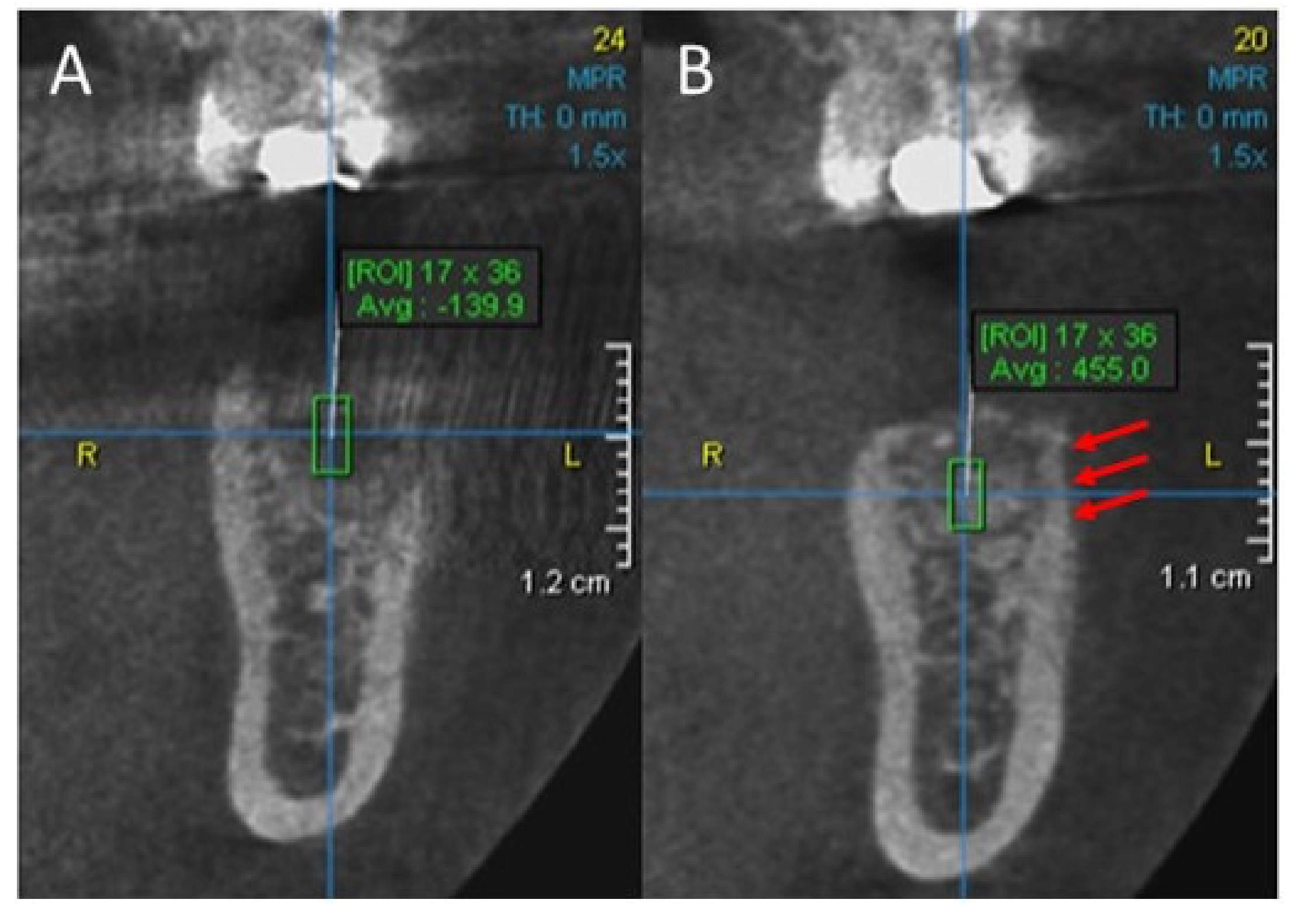 Ijerph 18 00206 g004