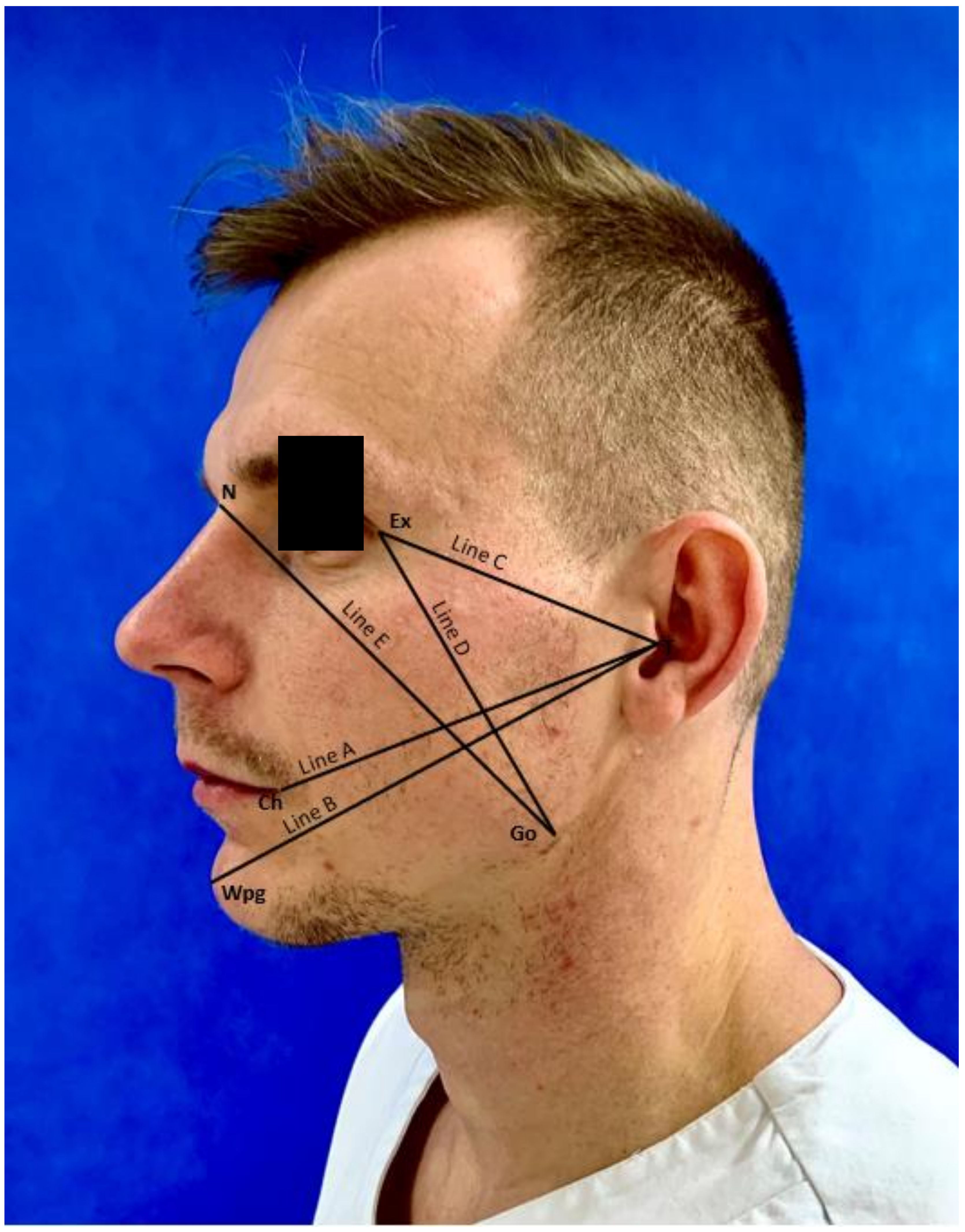 Ijerph 18 00399 g002 Ijerph 18 00399 g002