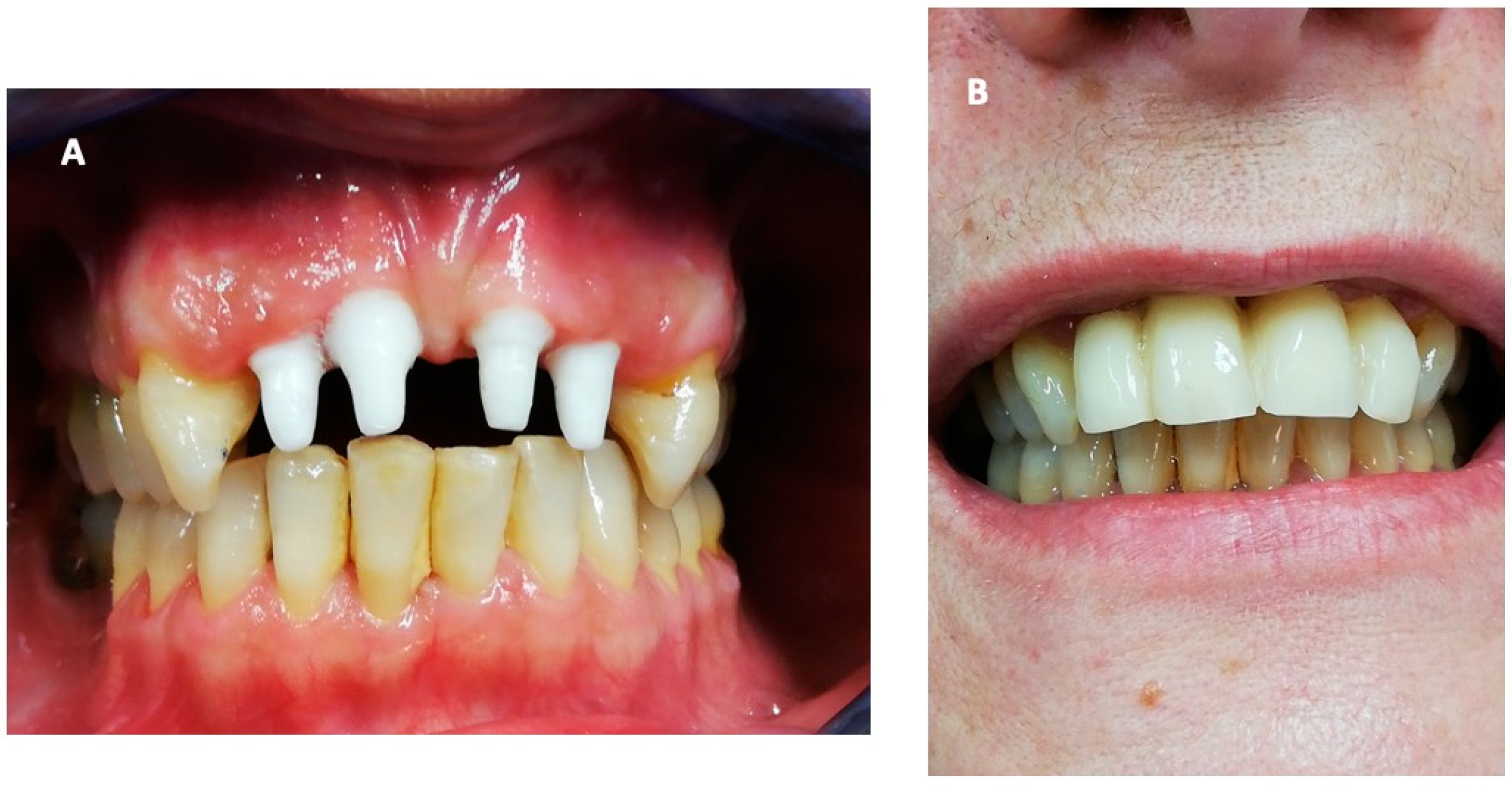 Ijerph 18 00413 g005 Ijerph 18 00413 g005