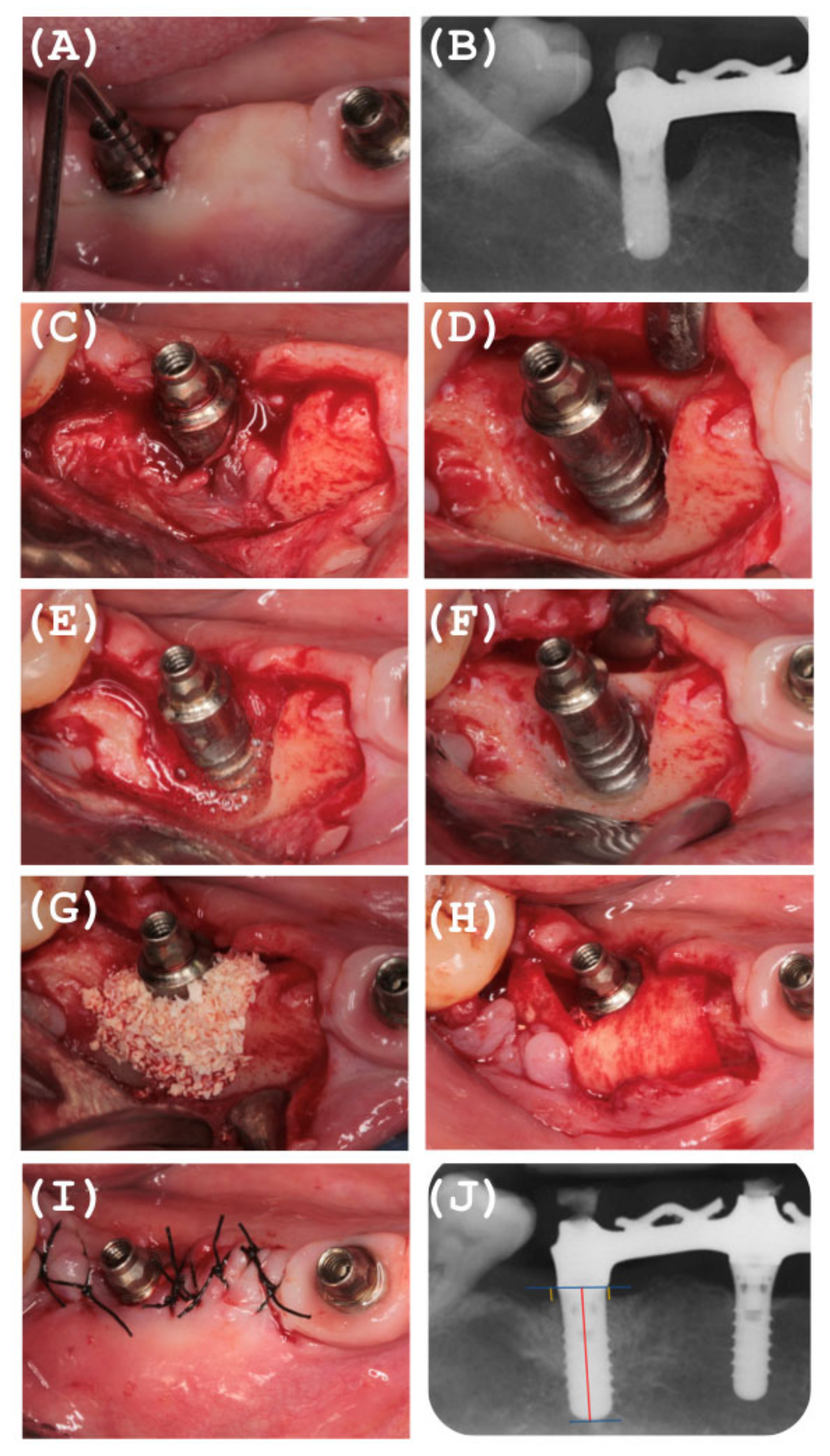 Ijerph 18 00645 g004