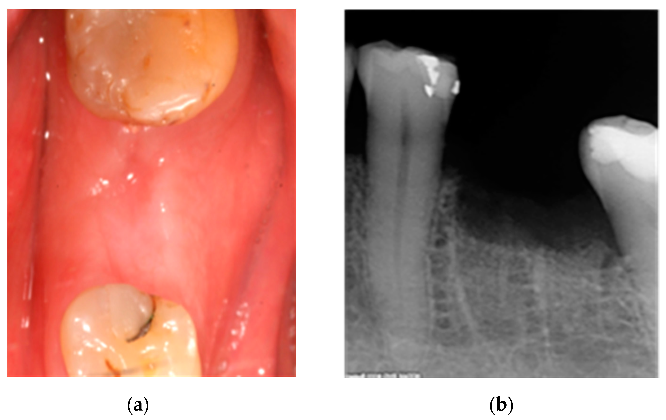 Ijerph 18 01018 g002 Ijerph 18 01018 g002