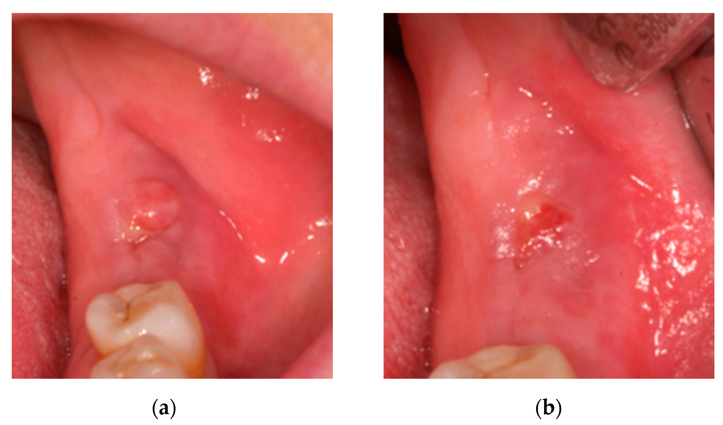 Ijerph 18 01018 g004 Ijerph 18 01018 g004