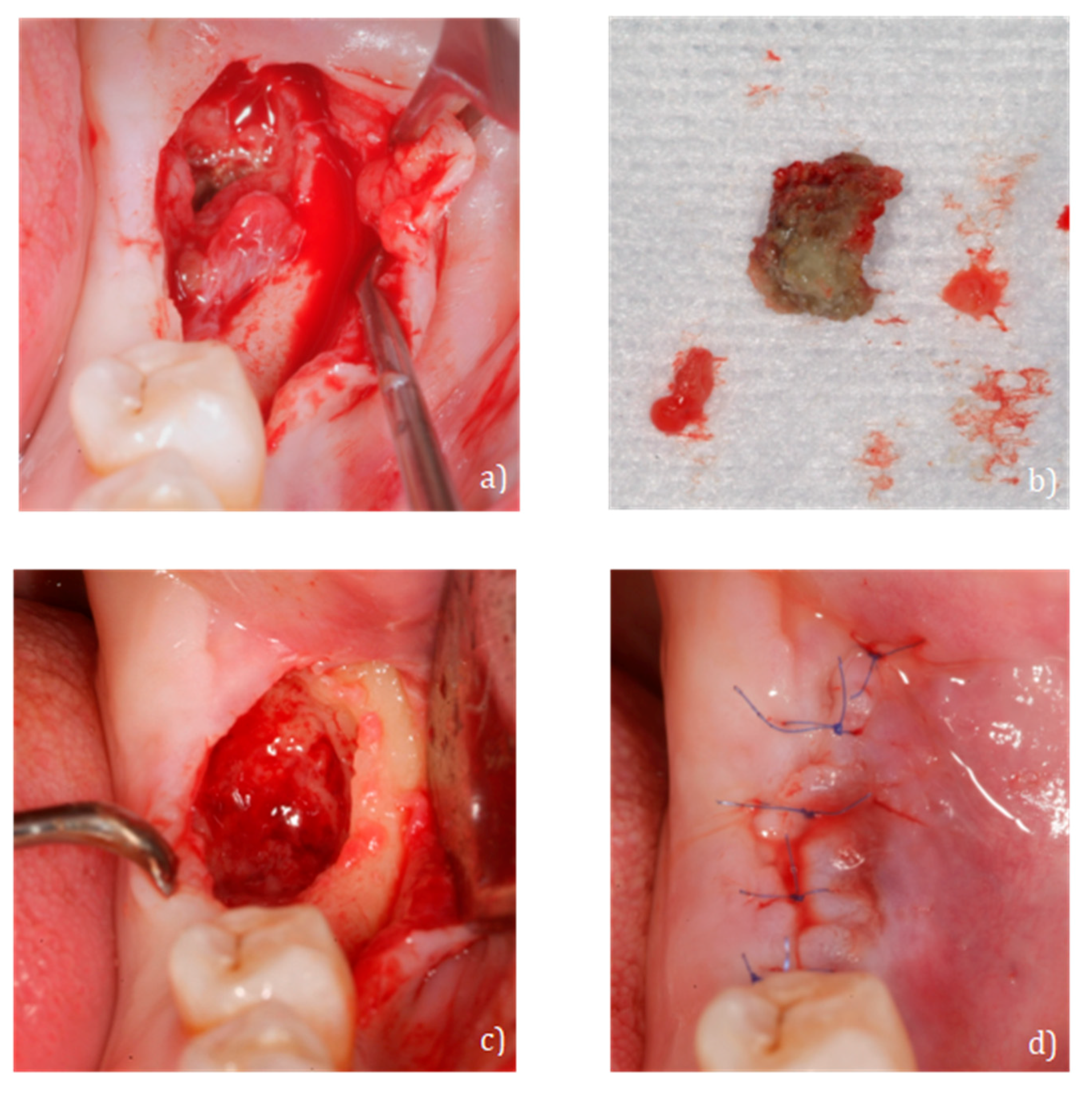 Ijerph 18 01018 g005 Ijerph 18 01018 g005