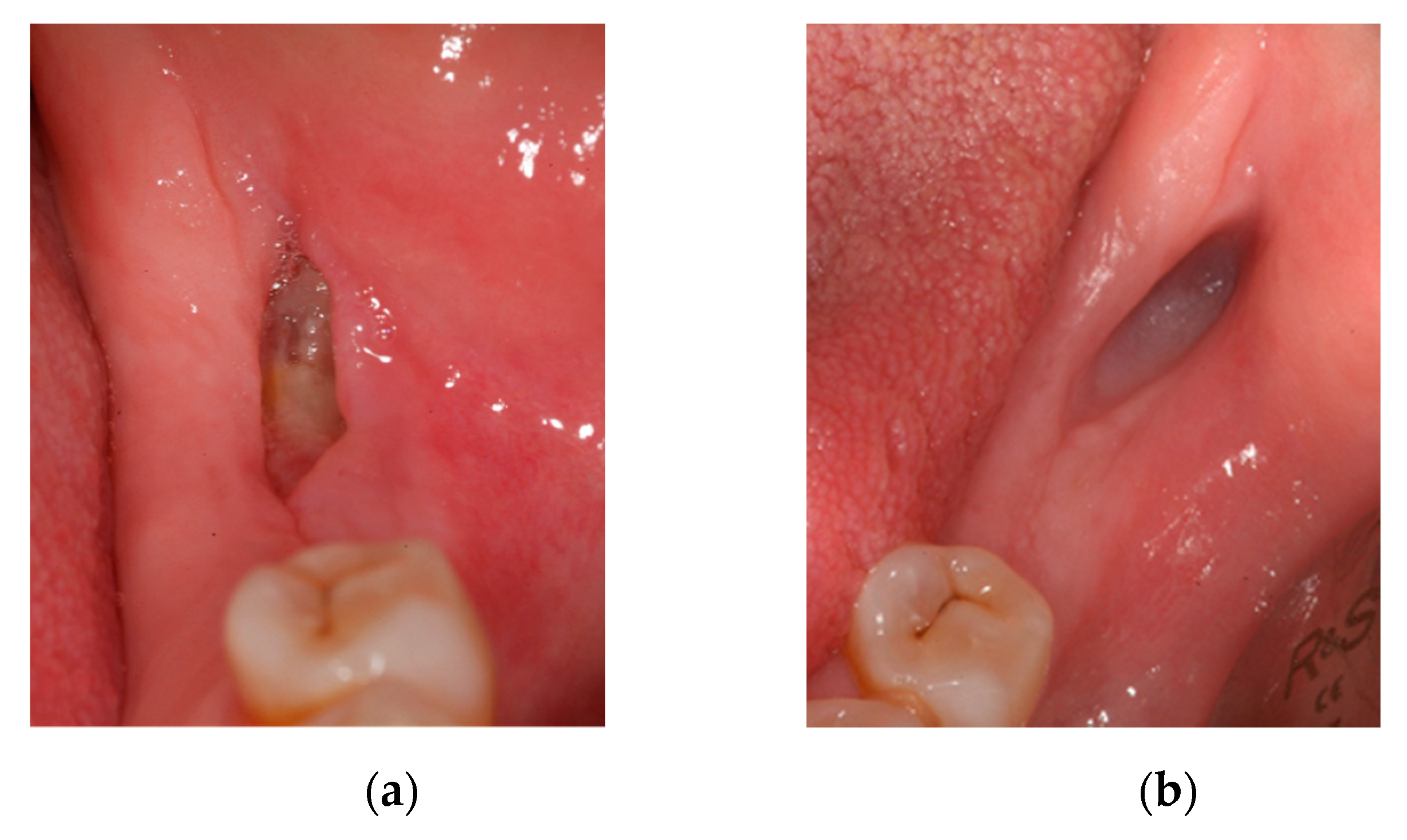 Ijerph 18 01018 g006a Ijerph 18 01018 g006a