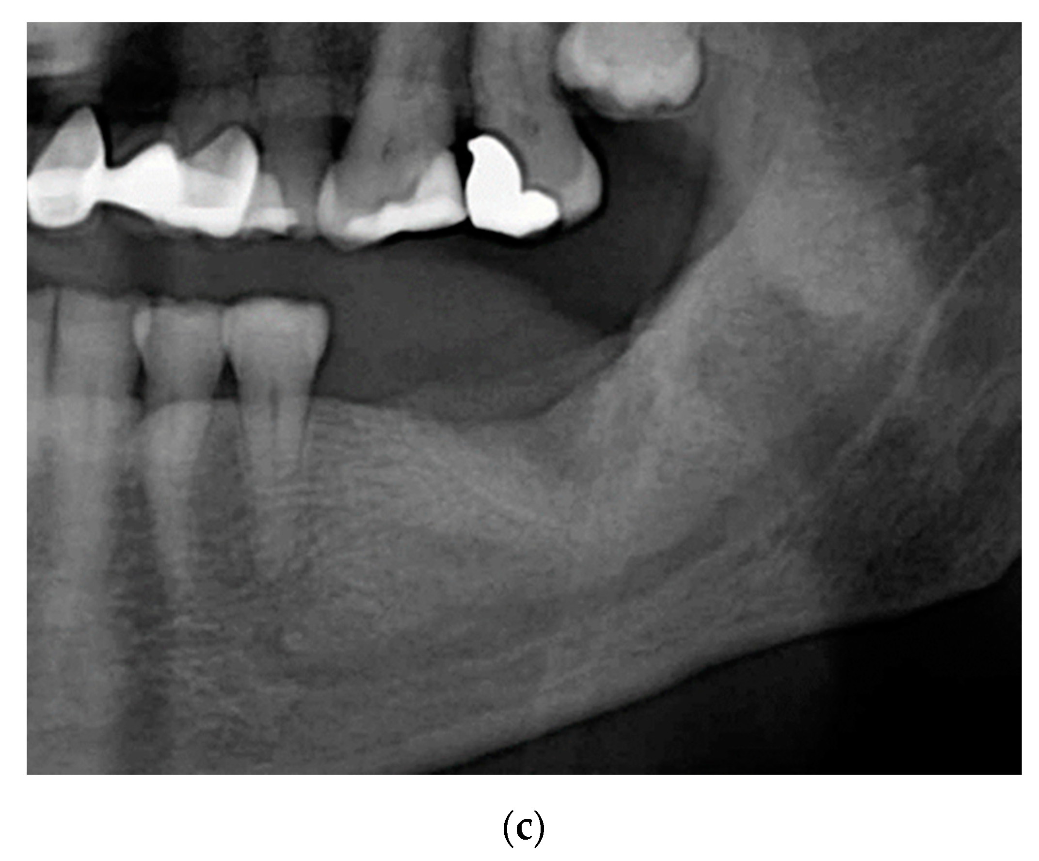 Ijerph 18 01018 g006b Ijerph 18 01018 g006b