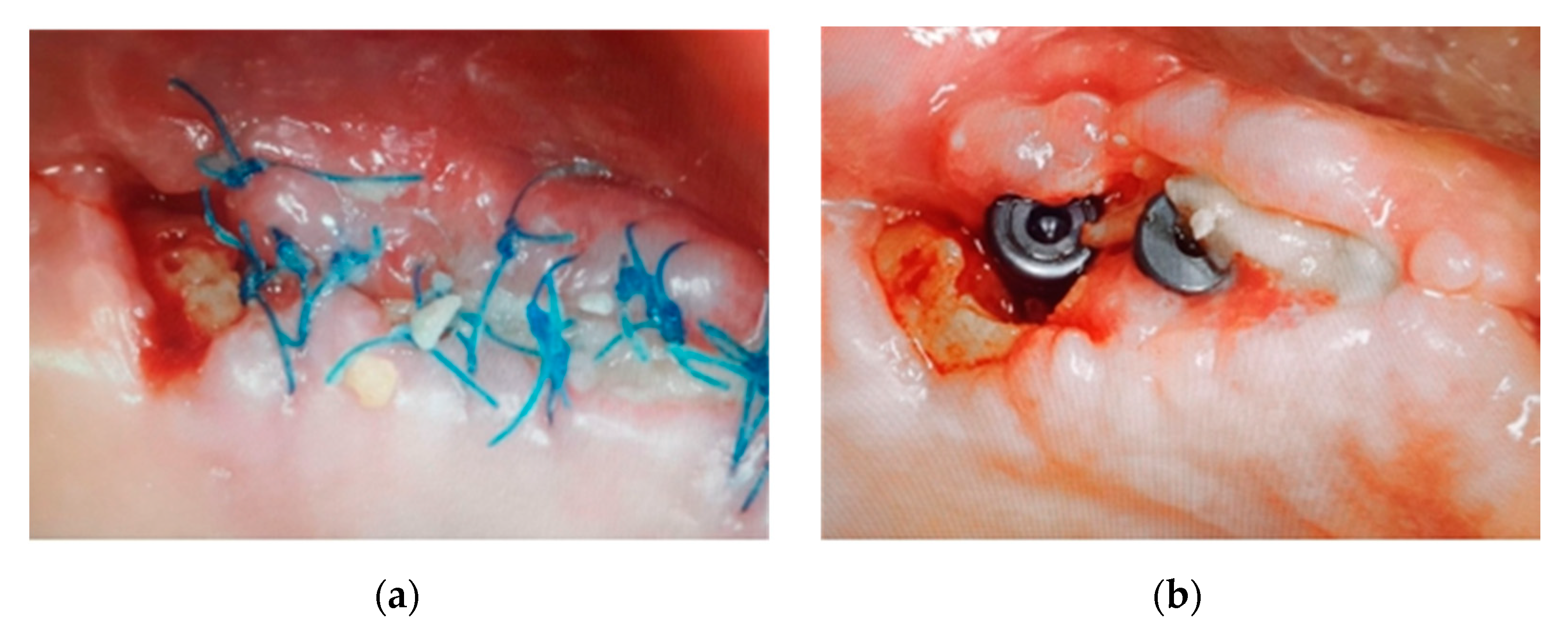 Ijerph 18 01018 g007 Ijerph 18 01018 g007