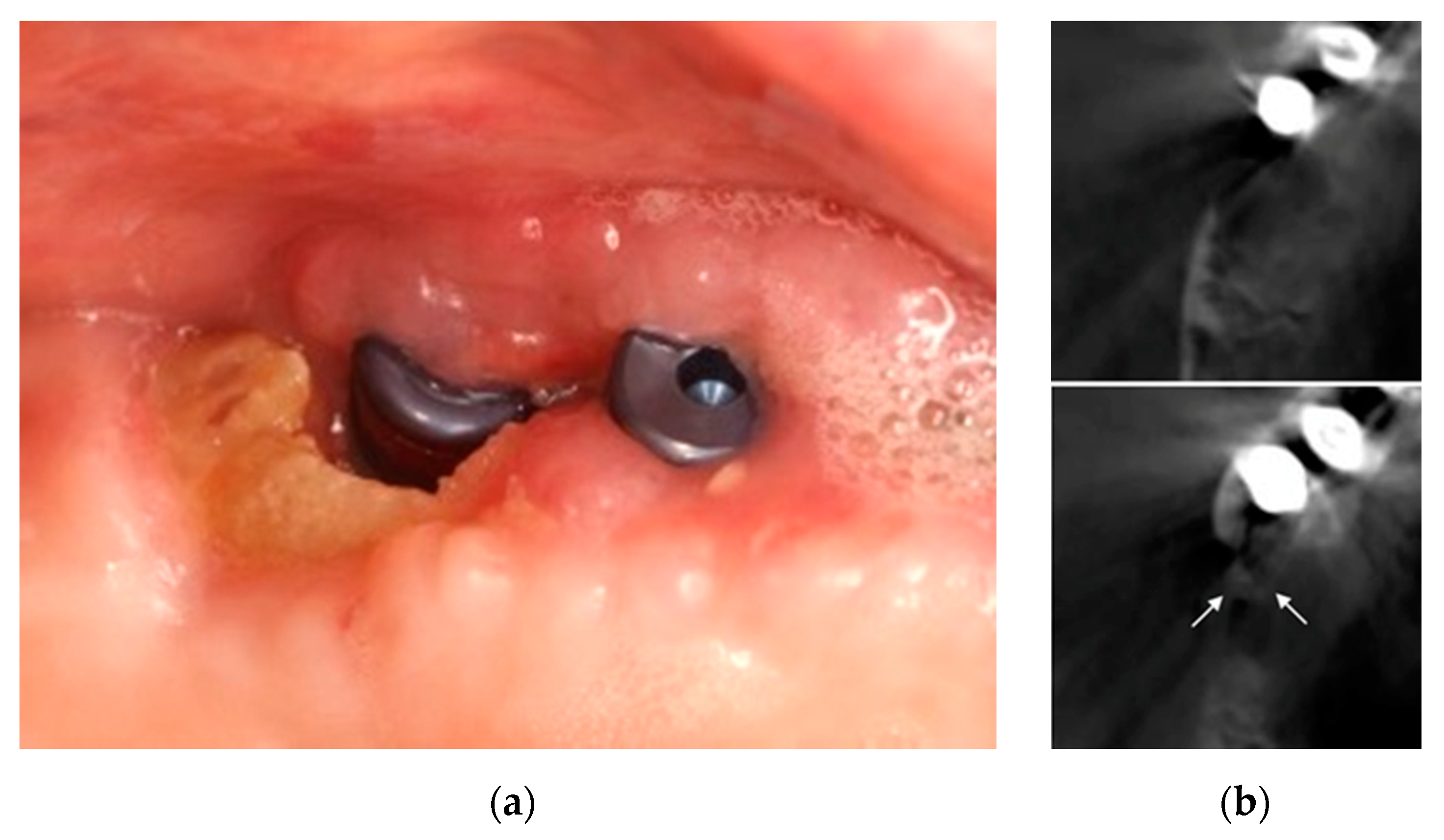 Ijerph 18 01018 g008 Ijerph 18 01018 g008