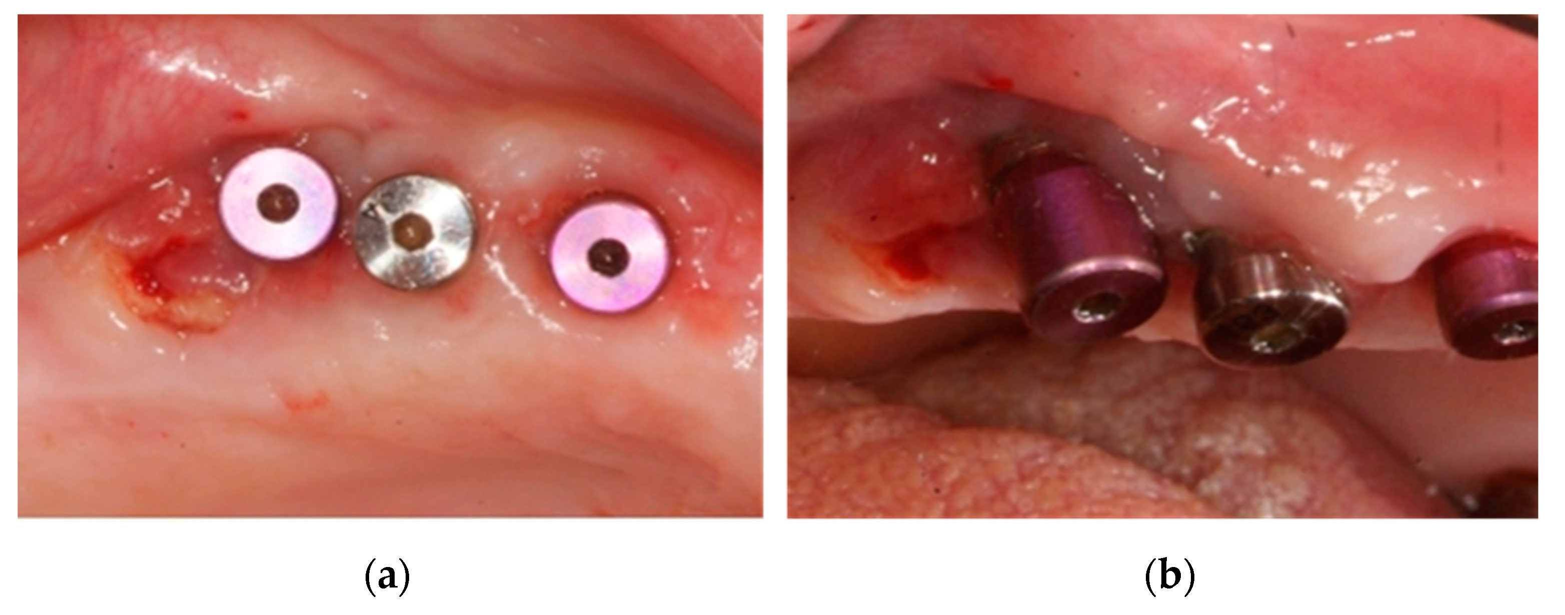 Ijerph 18 01018 g009 Ijerph 18 01018 g009