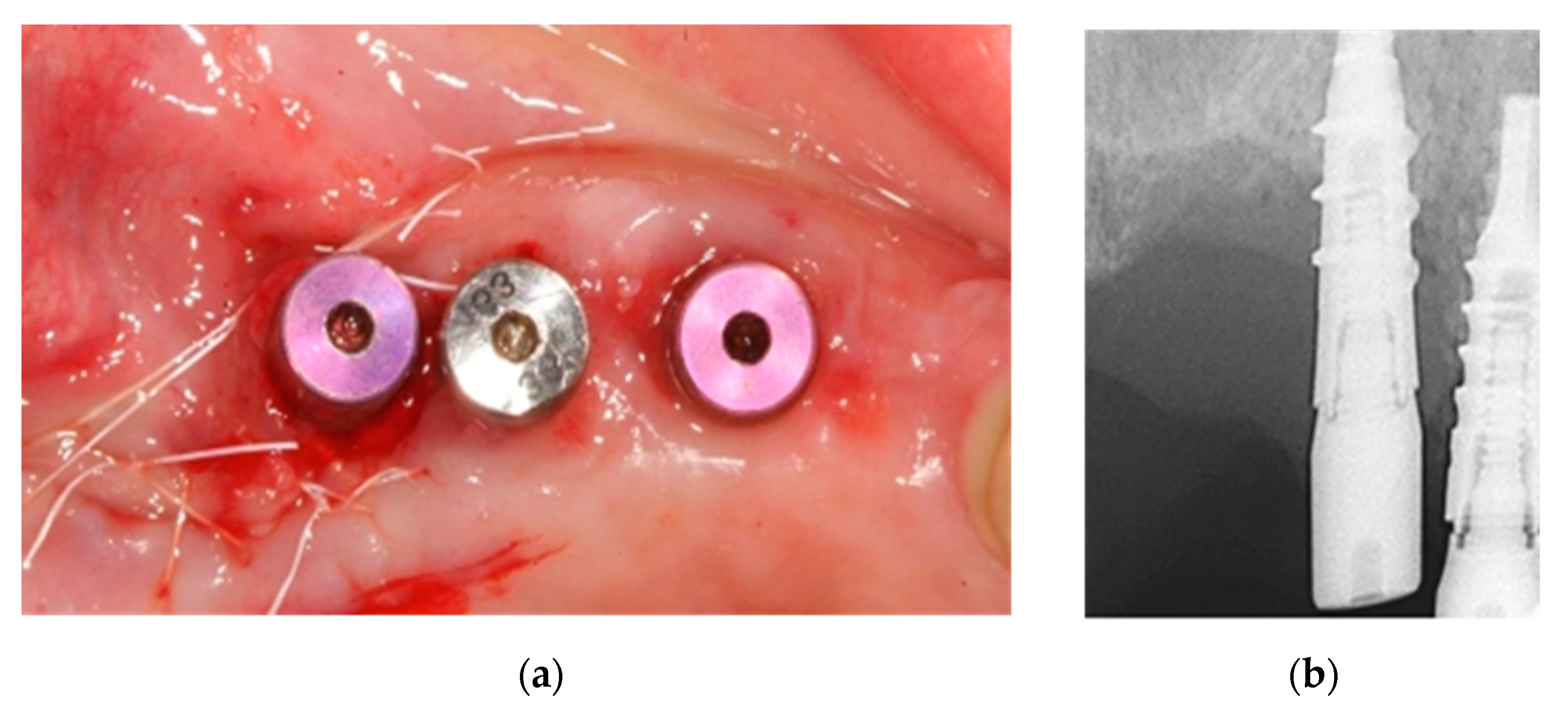 Ijerph 18 01018 g012 Ijerph 18 01018 g012