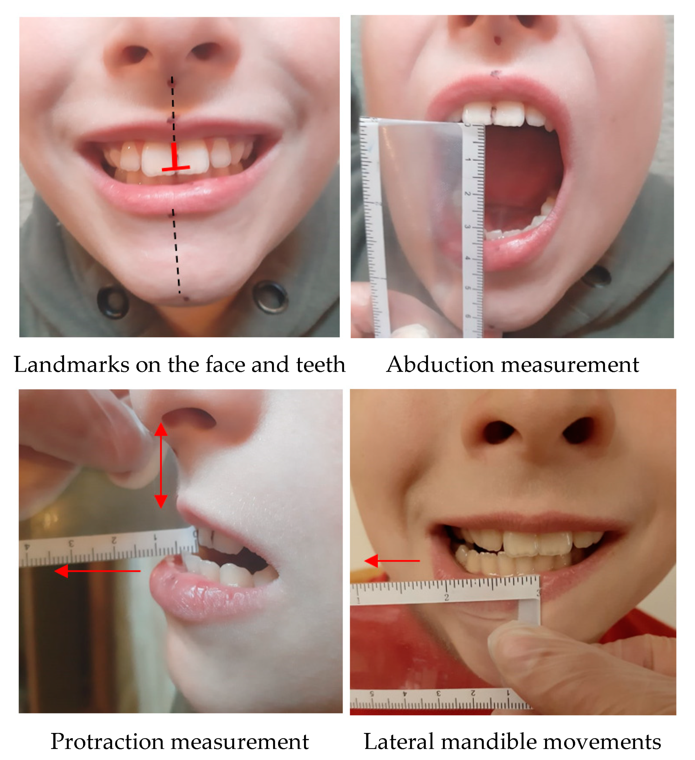 Ijerph 18 01076 g002 Ijerph 18 01076 g002