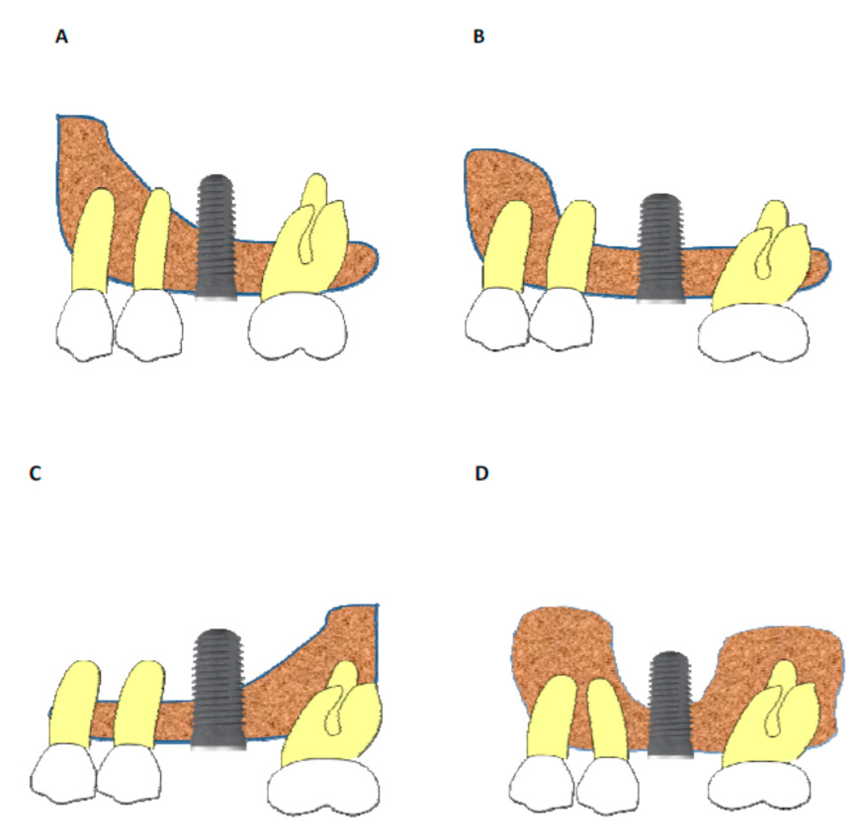 Ijerph 18 01103 g003 Ijerph 18 01103 g003